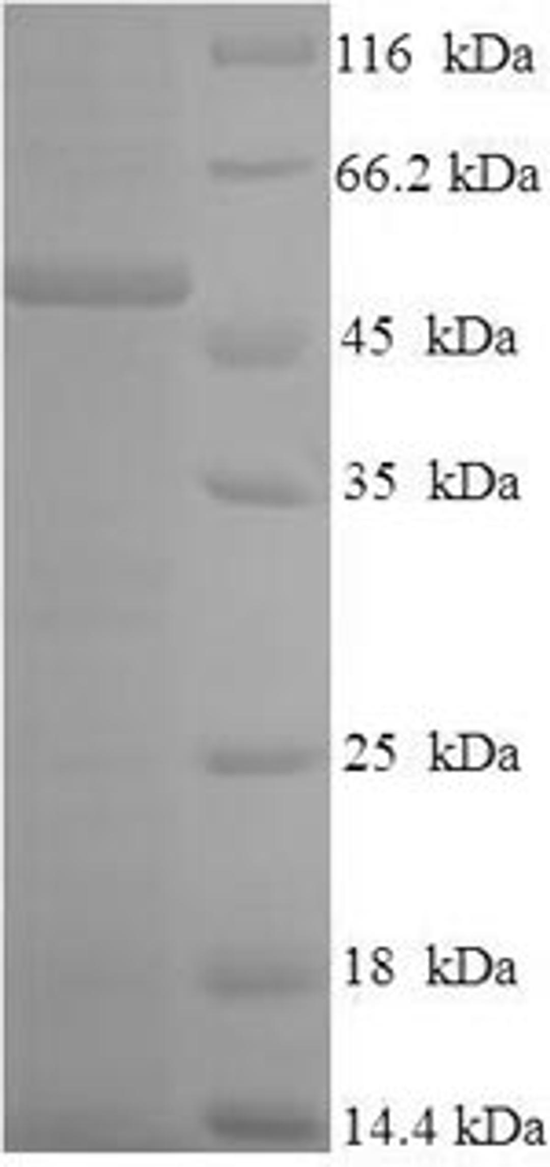 (Tris-Glycine gel) Discontinuous SDS-PAGE (reduced) with 5% enrichment gel and 15% separation gel.