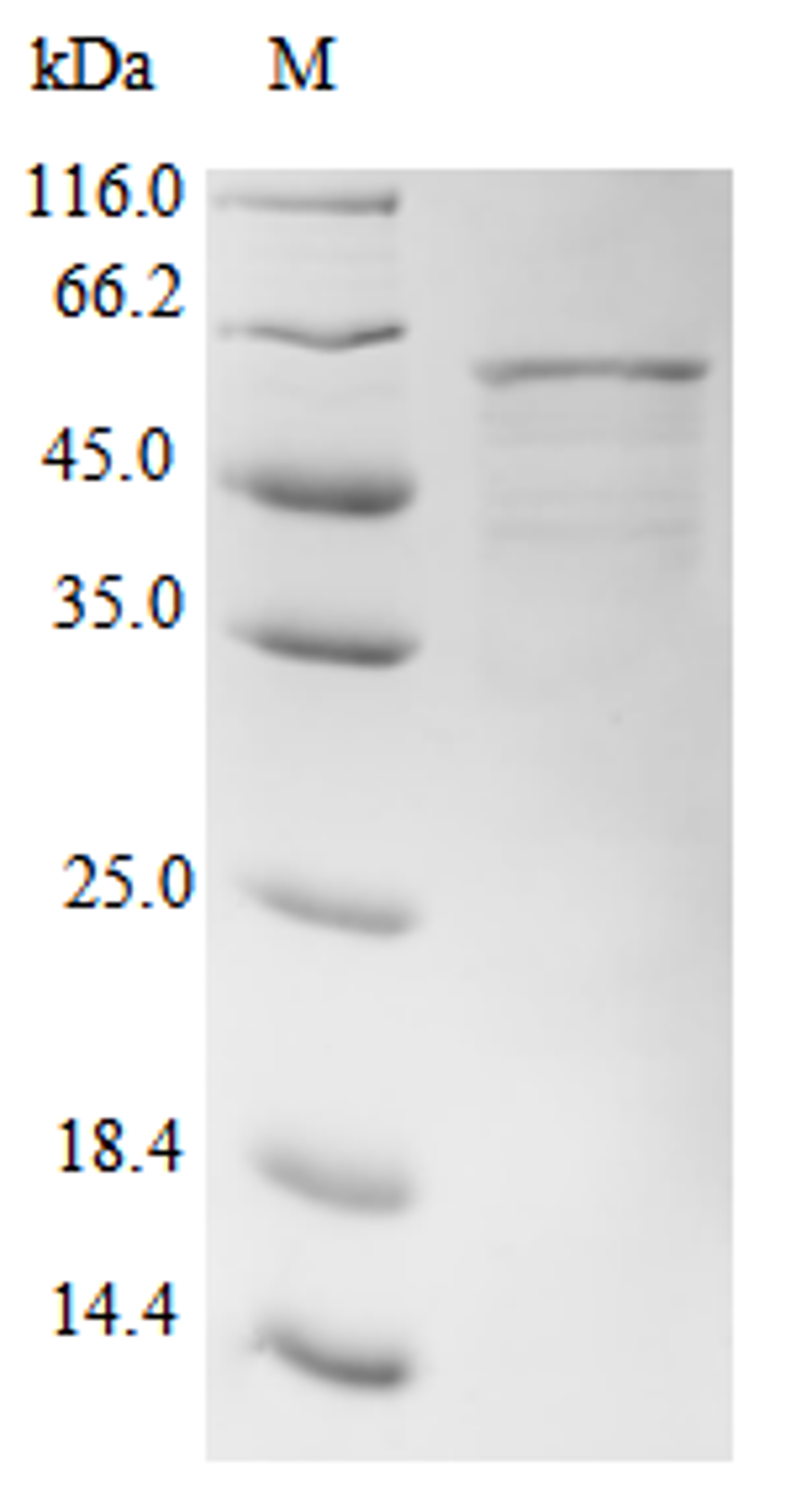 (Tris-Glycine gel) Discontinuous SDS-PAGE (reduced) with 5% enrichment gel and 15% separation gel.