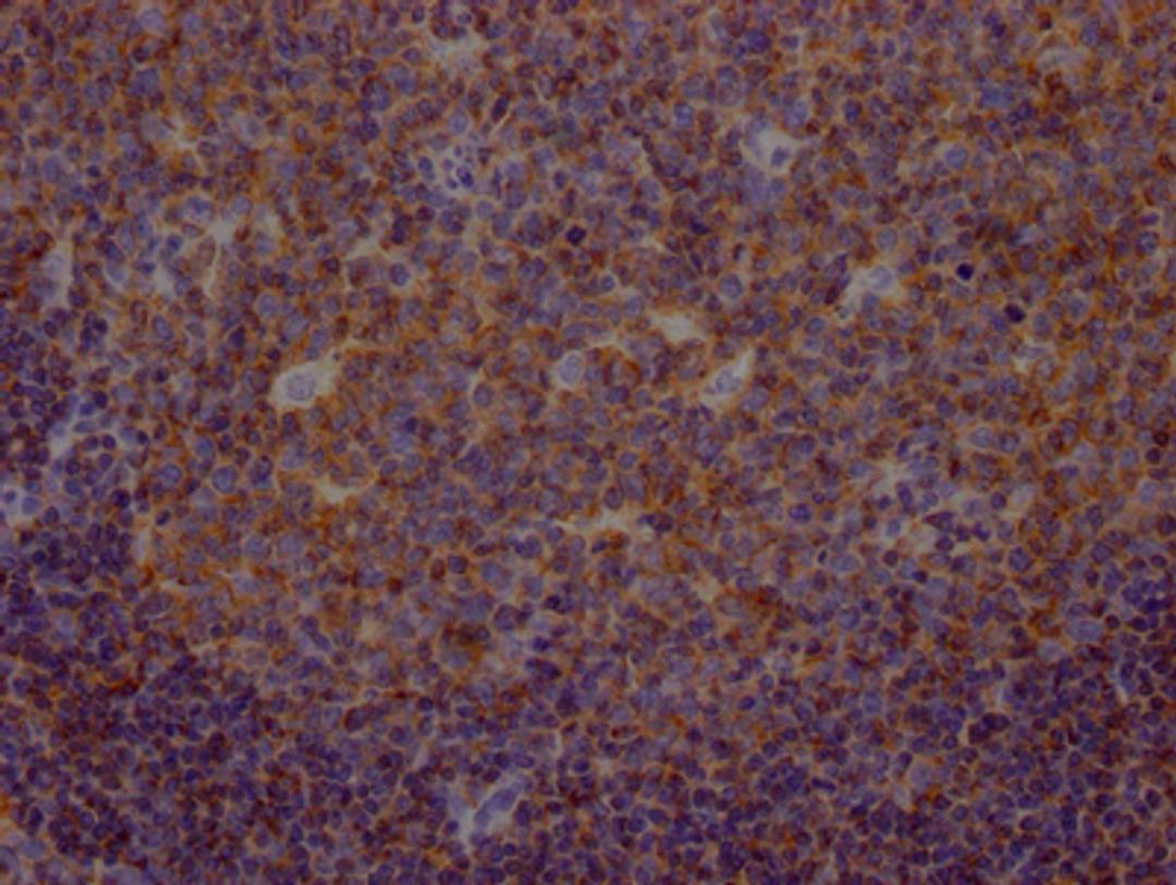 IHC image of CSB-RA294332A0HU diluted at 1:100 and staining in paraffin-embedded human tonsil tissue performed on a Leica BondTM system. After dewaxing and hydration, antigen retrieval was mediated by high pressure in a citrate buffer (pH 6.0). Section was blocked with 10% normal goat serum 30min at RT. Then primary antibody (1% BSA) was incubated at 4℃ overnight. The primary is detected by a Goat anti-rabbit IgG polymer labeled by HRP and visualized using 0.05% DAB.