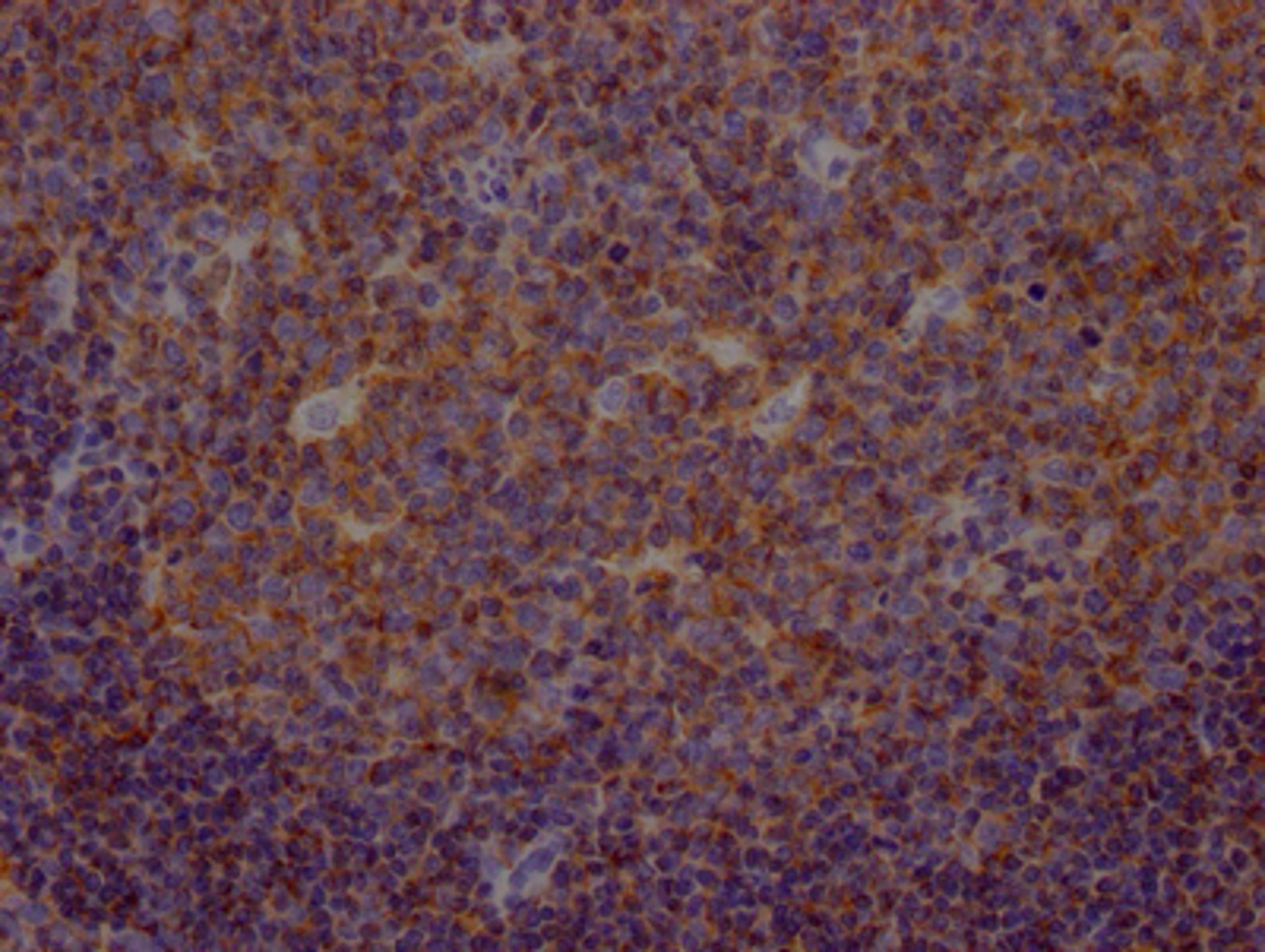 IHC image of CSB-RA294332A0HU diluted at 1:100 and staining in paraffin-embedded human tonsil tissue performed on a Leica BondTM system. After dewaxing and hydration, antigen retrieval was mediated by high pressure in a citrate buffer (pH 6.0). Section was blocked with 10% normal goat serum 30min at RT. Then primary antibody (1% BSA) was incubated at 4℃ overnight. The primary is detected by a Goat anti-rabbit IgG polymer labeled by HRP and visualized using 0.05% DAB.