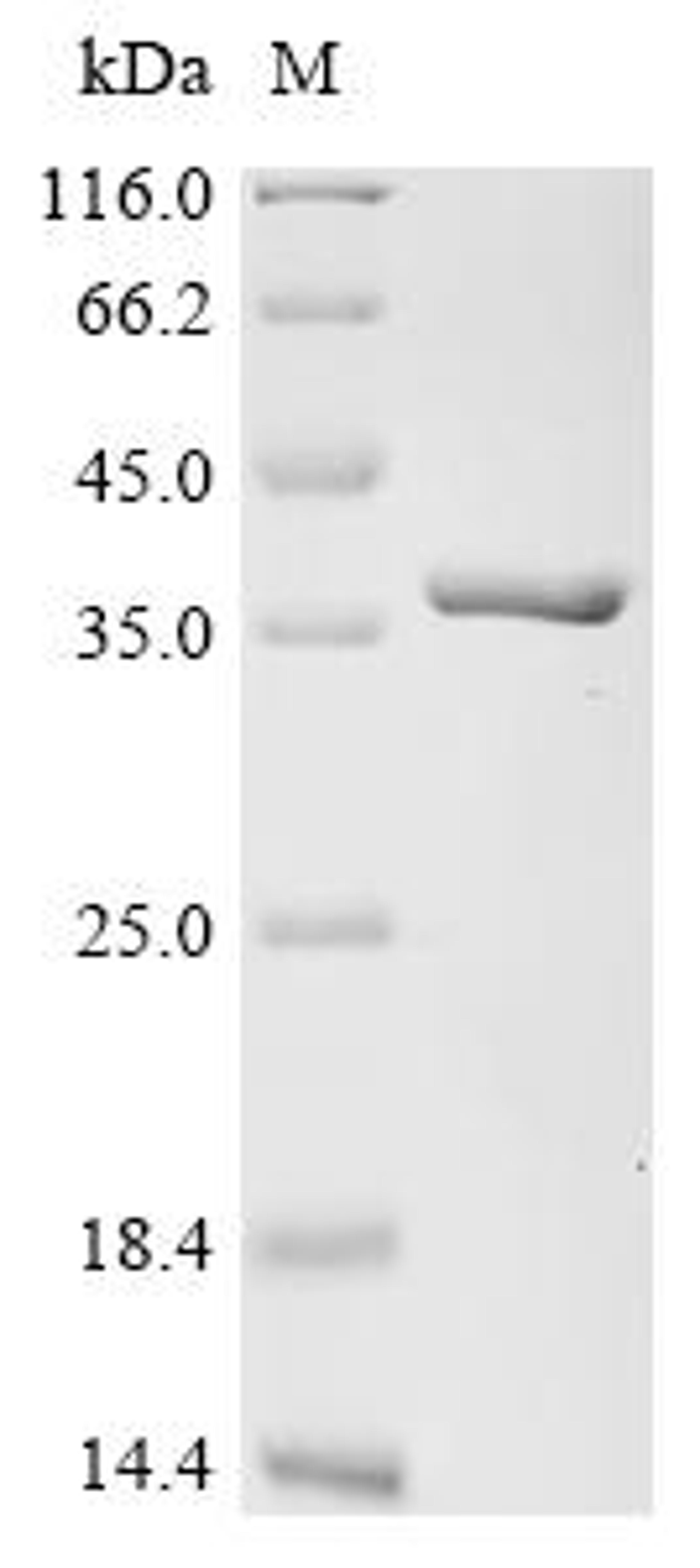 (Tris-Glycine gel) Discontinuous SDS-PAGE (reduced) with 5% enrichment gel and 15% separation gel.