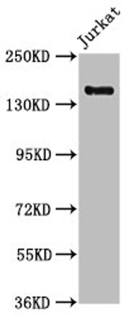 Western Blot. Positive WB detected in: Jurkat whole cell lysate. All lanes: CARMIL2 antibody at 1:1000. Secondary. Goat polyclonal to rabbit IgG at 1/50000 dilution. Predicted band size: 155, 149 kDa. Observed band size: 155 kDa. 