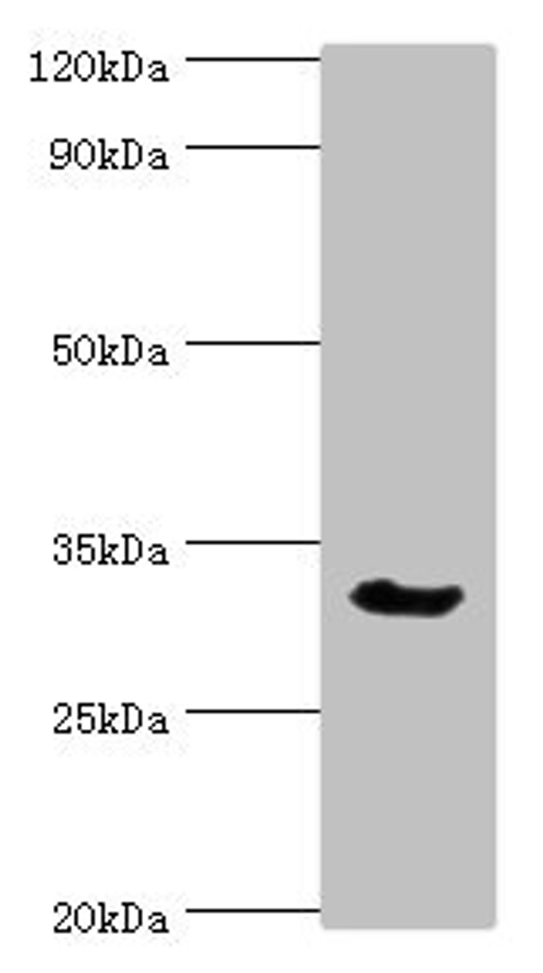 Western blot. All lanes: Caspase-6 antibody at 3ug/ml + Mouse liver tissue. Secondary. Goat polyclonal to rabbit IgG at 1/10000 dilution. Predicted band size: 34, 23 kDa. Observed band size: 34 kDa. 
