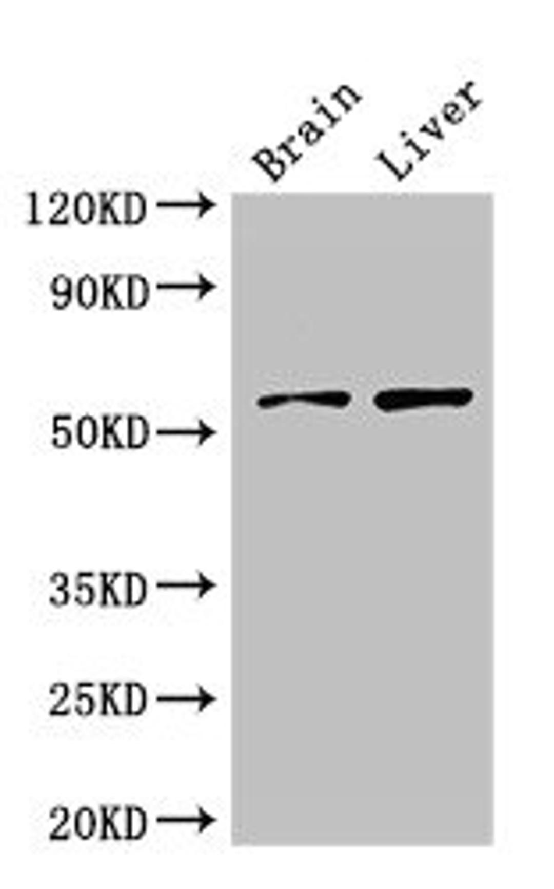 Western Blot. Positive WB detected in: Mouse brain tissue, Rat liver tissue. All lanes: KCNA1 antibody at 3ug/ml. Secondary. Goat polyclonal to rabbit IgG at 1/50000 dilution. Predicted band size: 57 kDa. Observed band size: 57 kDa. 