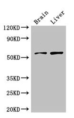 Western Blot. Positive WB detected in: Mouse brain tissue, Rat liver tissue. All lanes: KCNA1 antibody at 3ug/ml. Secondary. Goat polyclonal to rabbit IgG at 1/50000 dilution. Predicted band size: 57 kDa. Observed band size: 57 kDa. 