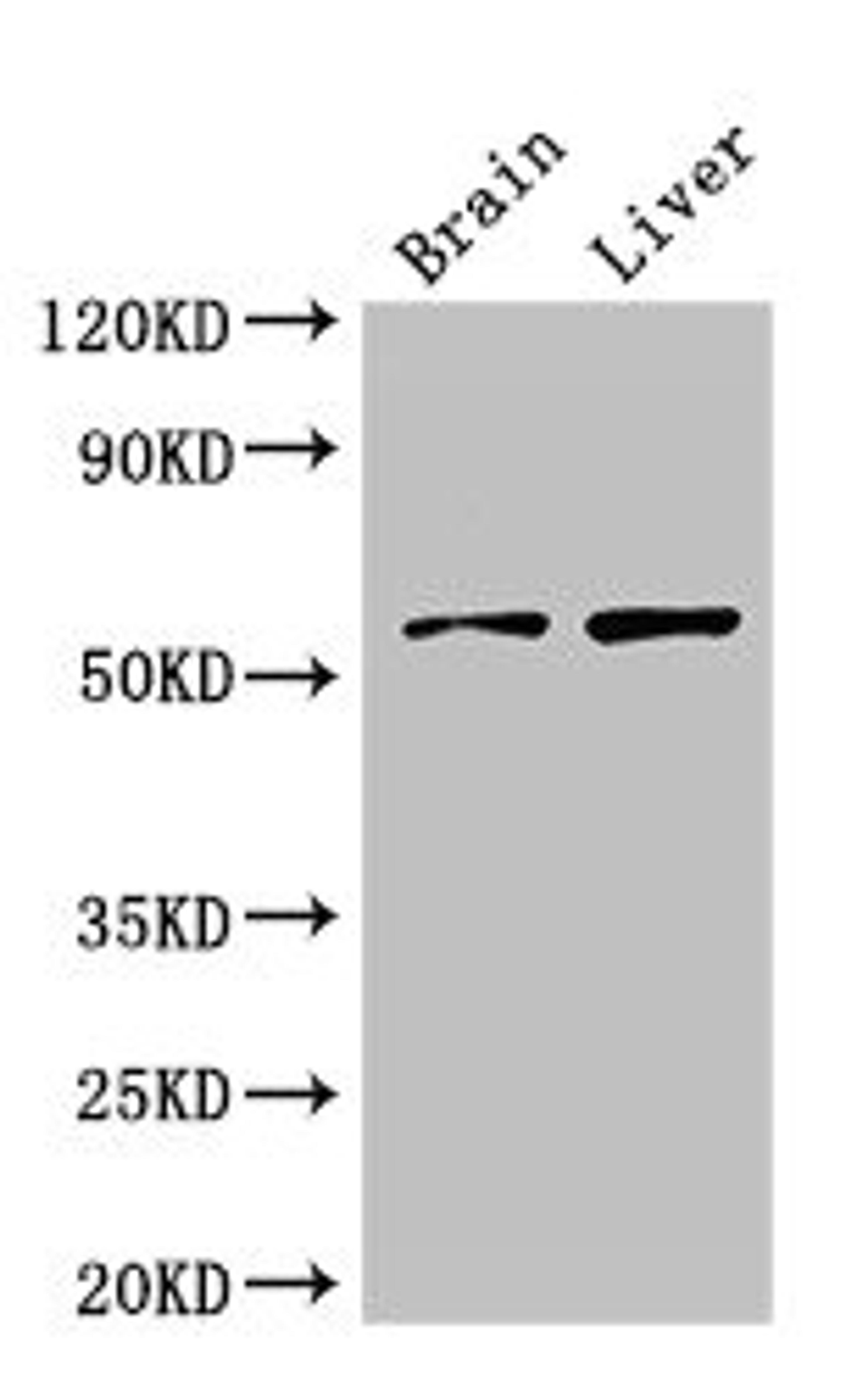Western Blot. Positive WB detected in: Mouse brain tissue, Rat liver tissue. All lanes: KCNA1 antibody at 3ug/ml. Secondary. Goat polyclonal to rabbit IgG at 1/50000 dilution. Predicted band size: 57 kDa. Observed band size: 57 kDa. 