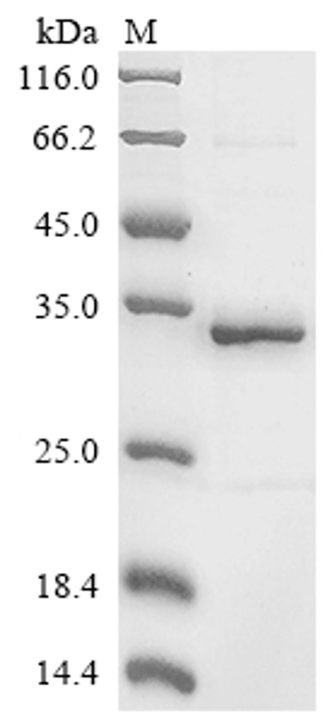 (Tris-Glycine gel) Discontinuous SDS-PAGE (reduced) with 5% enrichment gel and 15% separation gel.