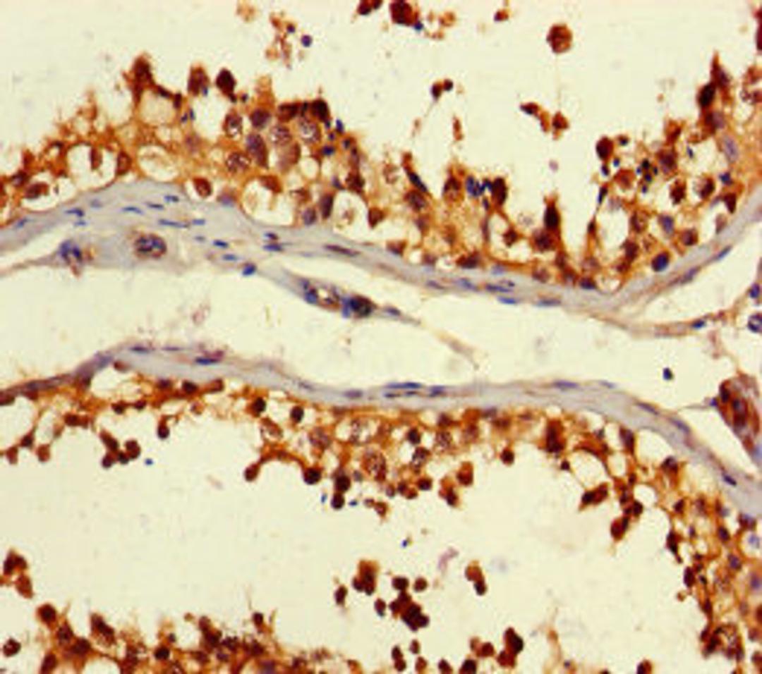 Immunohistochemistry of paraffin-embedded human testis tissue using CSB-PA526319HA01HU at dilution of 1:100