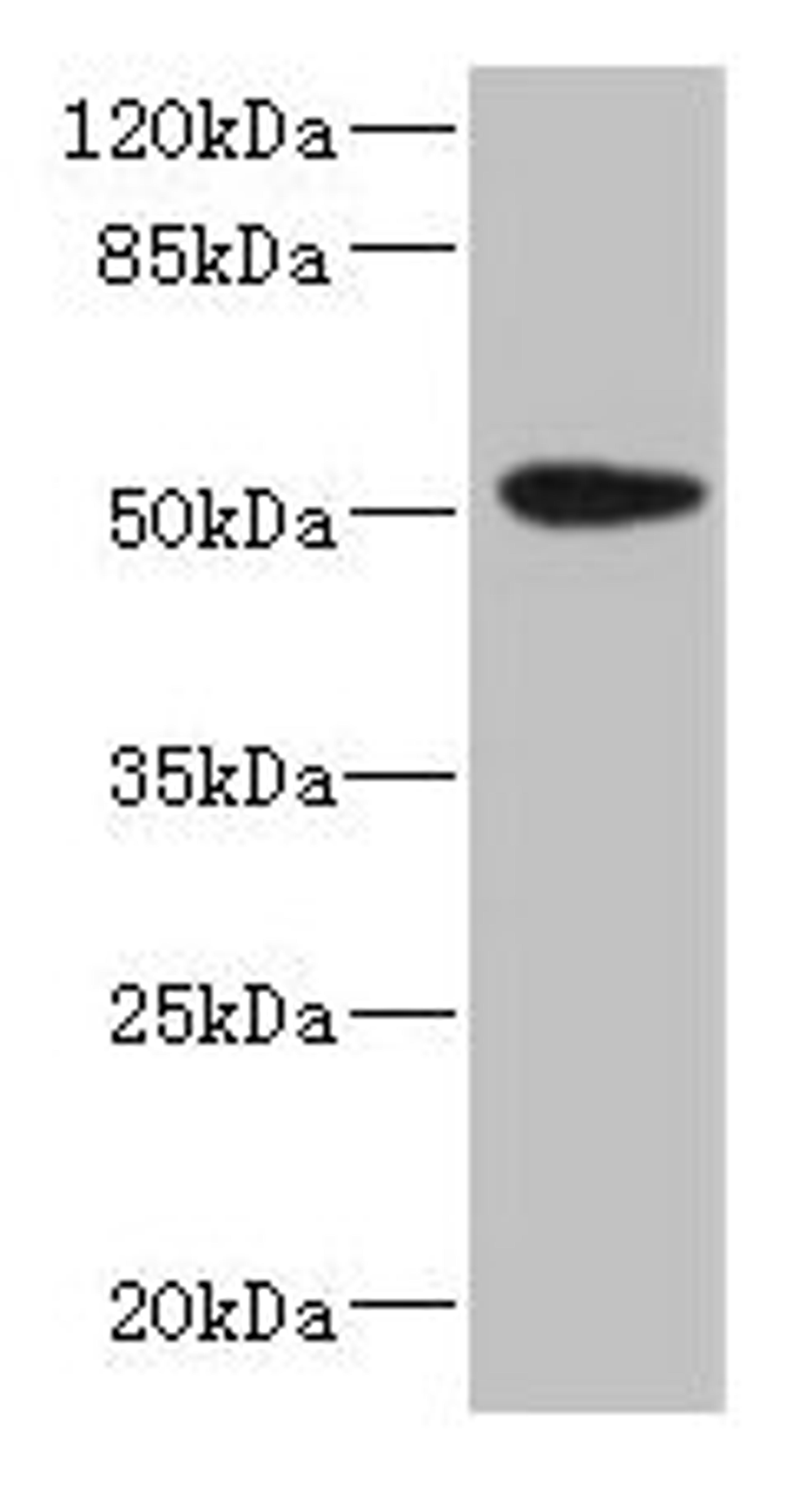 Western blot. All lanes: KRT35 antibody at 4µg/ml + PC-3 whole cell lysate. Secondary. Goat polyclonal to rabbit IgG at 1/10000 dilution. Predicted band size: 51 kDa. Observed band size: 51 kDa