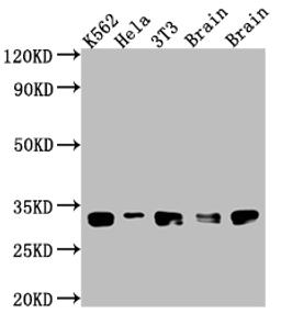 Western Blot. Positive WB detected in: K562 whole cell lysate, Hela whole cell lysate, NIH/3T3 whole cell lysate, Rat Brain whole cell lysate, Mouse Brain whole cell lysate. All lanes: Bcl-XL antibody at 1:1000. Secondary. Goat polyclonal to rabbit IgG at 1/50000 dilution. Predicted band size: 27, 19, 26 kDa. Observed band size: 30 kDa. 