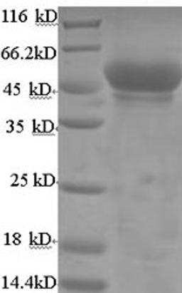 (Tris-Glycine gel) Discontinuous SDS-PAGE (reduced) with 5% enrichment gel and 15% separation gel.
