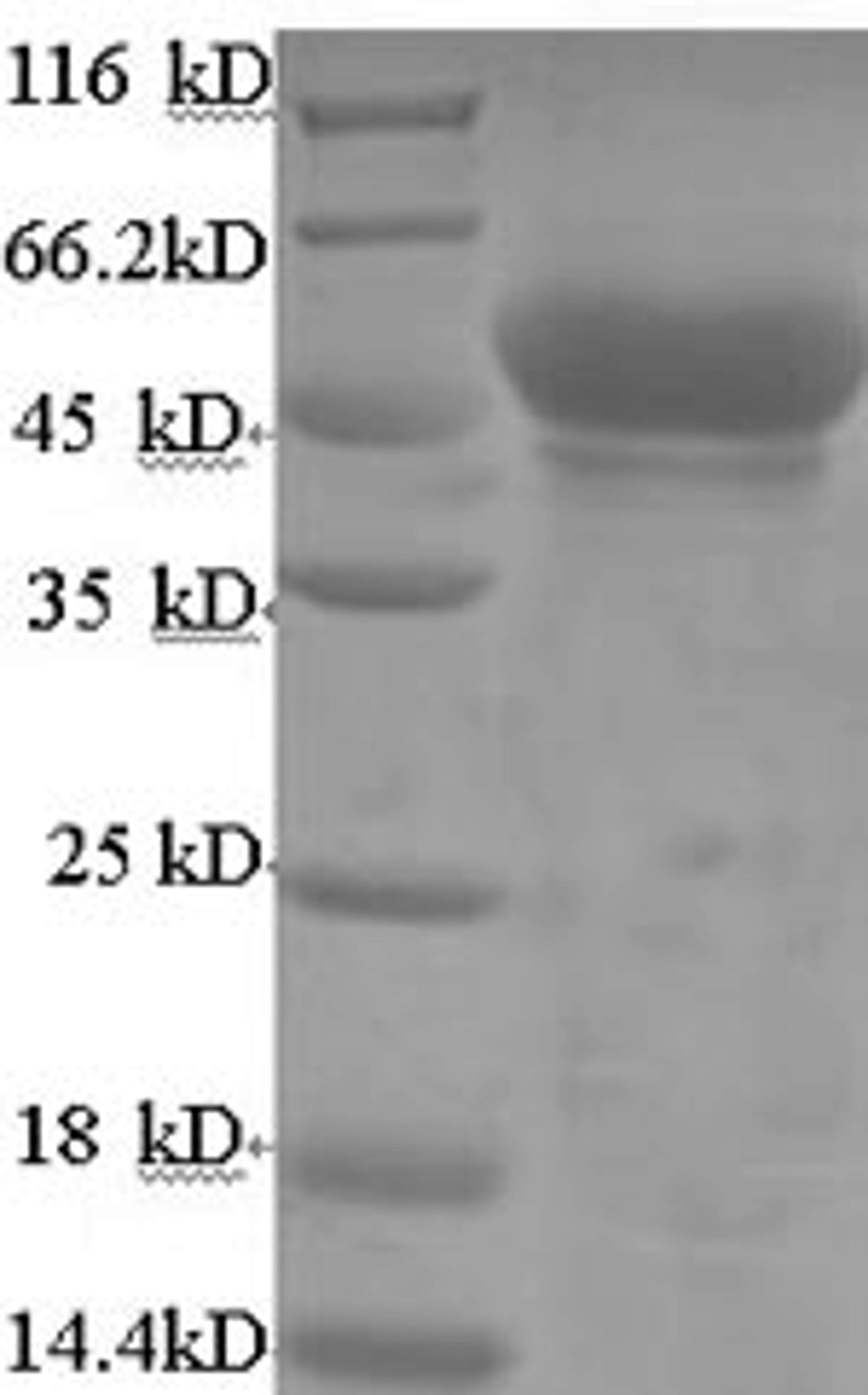 (Tris-Glycine gel) Discontinuous SDS-PAGE (reduced) with 5% enrichment gel and 15% separation gel.