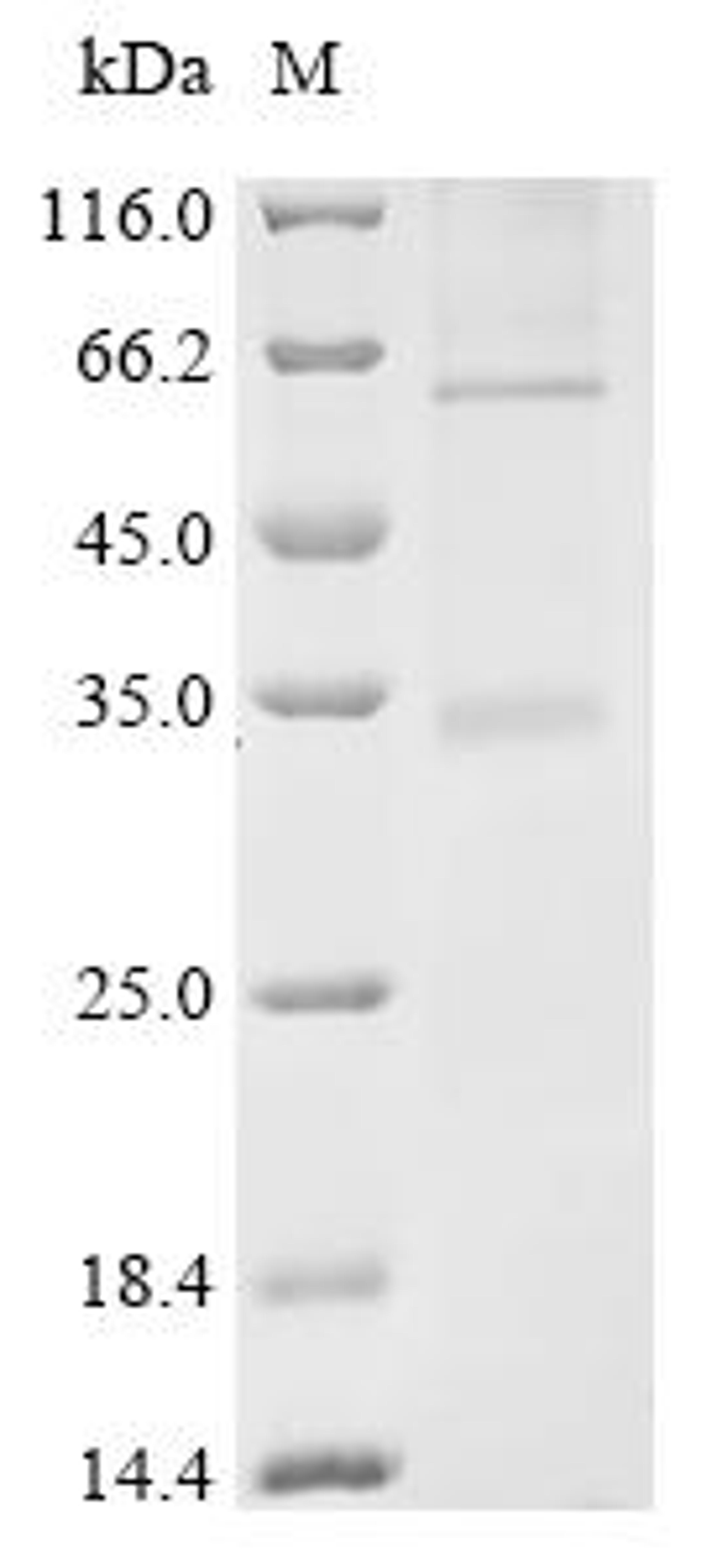 (Tris-Glycine gel) Discontinuous SDS-PAGE (reduced) with 5% enrichment gel and 15% separation gel.
