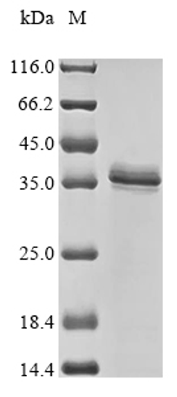 (Tris-Glycine gel) Discontinuous SDS-PAGE (reduced) with 5% enrichment gel and 15% separation gel.
