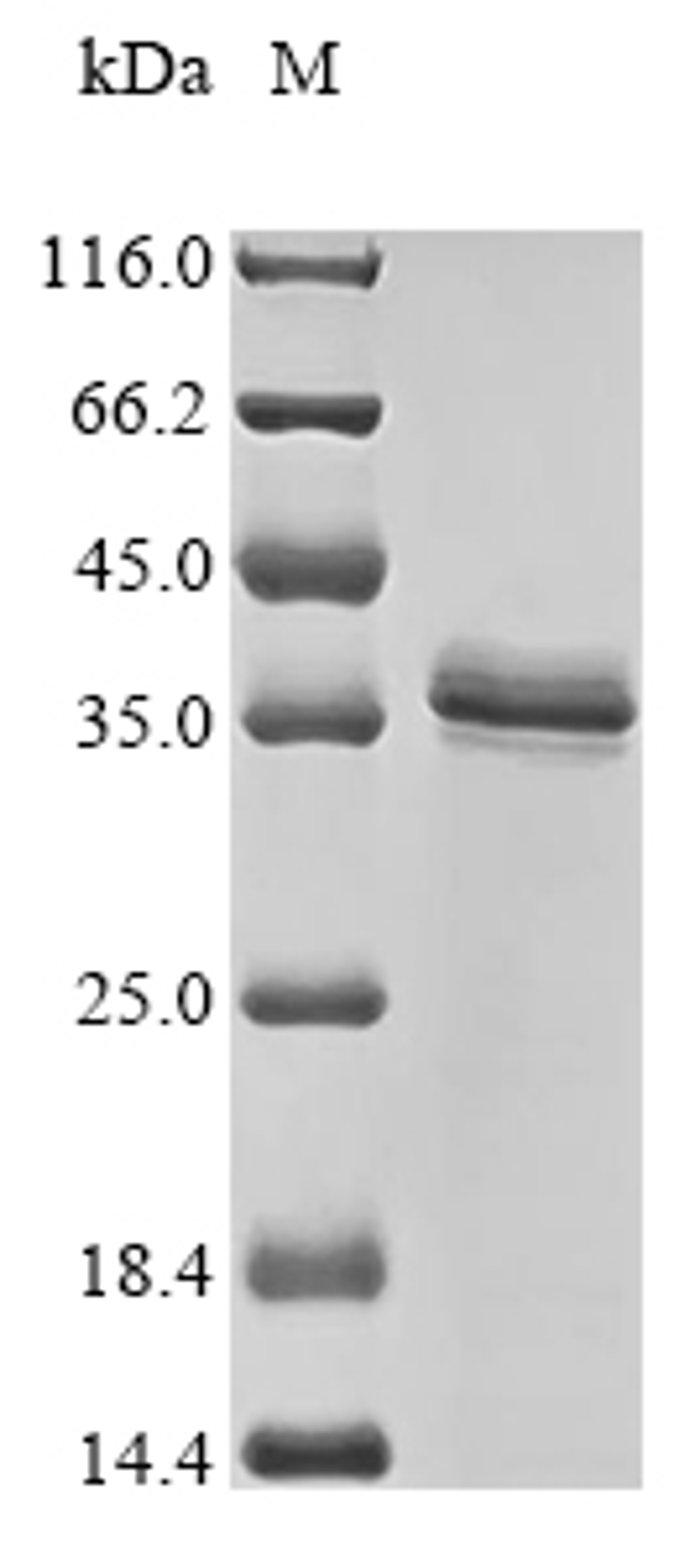 (Tris-Glycine gel) Discontinuous SDS-PAGE (reduced) with 5% enrichment gel and 15% separation gel.
