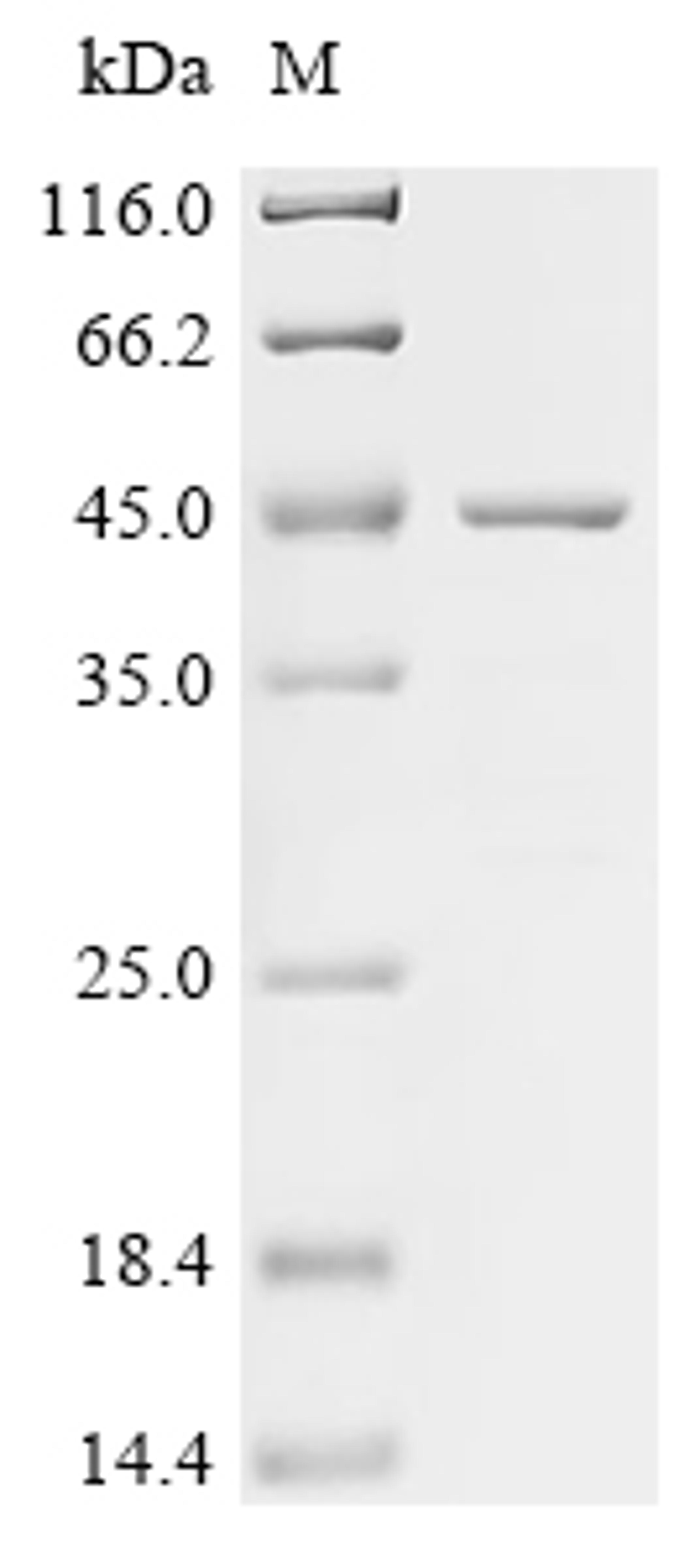 (Tris-Glycine gel) Discontinuous SDS-PAGE (reduced) with 5% enrichment gel and 15% separation gel.