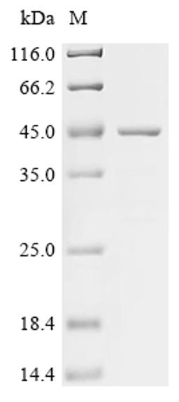 (Tris-Glycine gel) Discontinuous SDS-PAGE (reduced) with 5% enrichment gel and 15% separation gel.