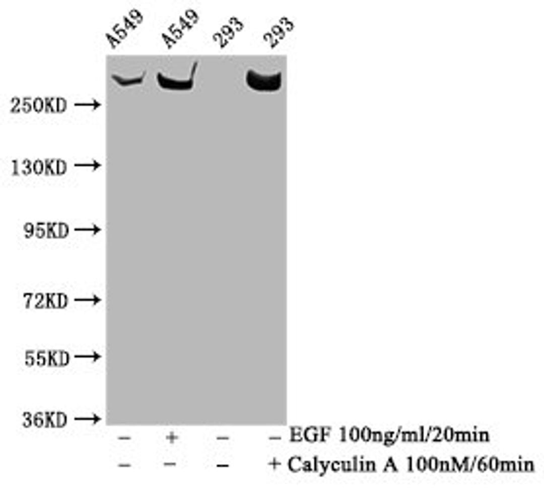 Western Blot. Positive WB detected in A549 whole cell lysate,293 whole cell lysate(treated with Calyculin A or EGF). All lanes Phospho-MTOR antibody at 1.33μg/ml. Secondary. Goat polyclonal to rabbit IgG at 1/50000 dilution. Predicted band size: 289 KDa. Observed band size: 289 KDa.