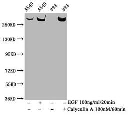 Western Blot. Positive WB detected in A549 whole cell lysate,293 whole cell lysate(treated with Calyculin A or EGF). All lanes Phospho-MTOR antibody at 1.33μg/ml. Secondary. Goat polyclonal to rabbit IgG at 1/50000 dilution. Predicted band size: 289 KDa. Observed band size: 289 KDa.