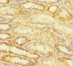 Immunohistochemistry of paraffin-embedded human kidney tissue using CSB-PA002437LA01HU at dilution of 1:100
