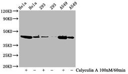 Western Blot. Positive WB detected in Hela whole cell lysate,293 whole cell lysate,A549 whole cell lysate(treated with Calyculin A or not). All lanes Phospho-GSK3B antibody at 0.77μg/ml. Secondary. Goat polyclonal to rabbit IgG at 1/50000 dilution. Predicted band size: 46 KDa. Observed band size: 46 KDa. 