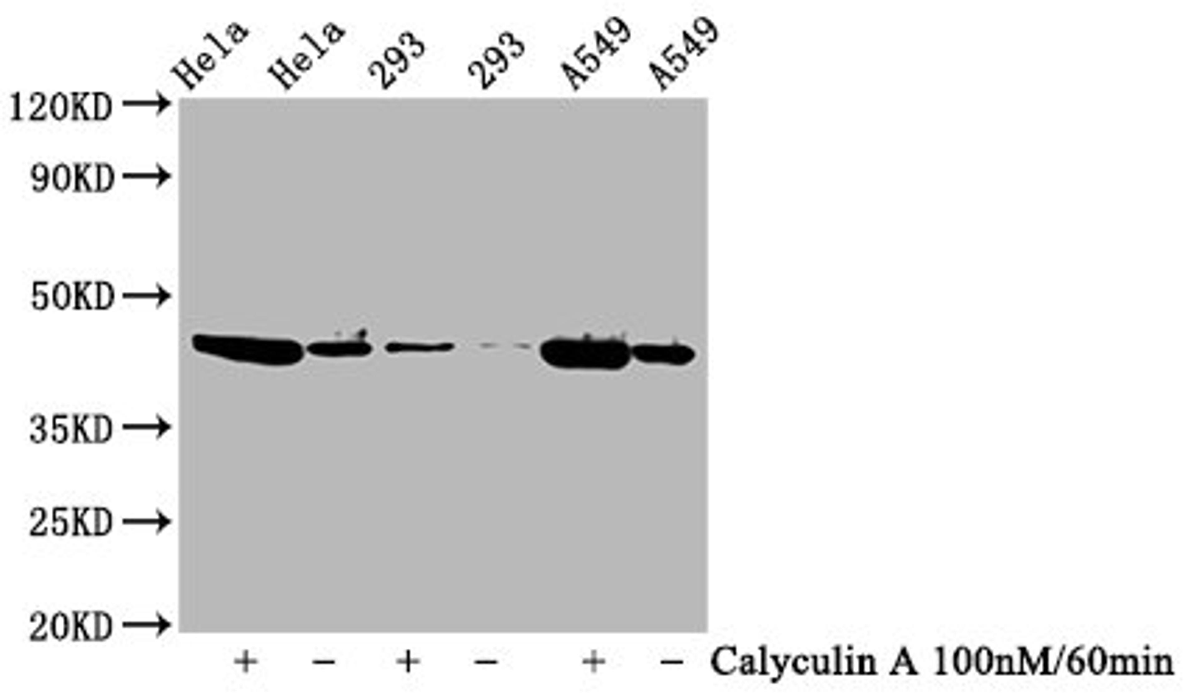 Western Blot. Positive WB detected in Hela whole cell lysate,293 whole cell lysate,A549 whole cell lysate(treated with Calyculin A or not). All lanes Phospho-GSK3B antibody at 0.77μg/ml. Secondary. Goat polyclonal to rabbit IgG at 1/50000 dilution. Predicted band size: 46 KDa. Observed band size: 46 KDa.