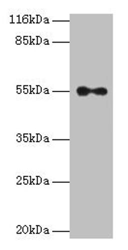 Western blot. All lanes: THRA antibody at 2µg/ml + A431 whole cell lysate. Secondary. Goat polyclonal to rabbit IgG at 1/10000 dilution. Predicted band size: 55, 47, 51 kDa. Observed band size: 55 kDa