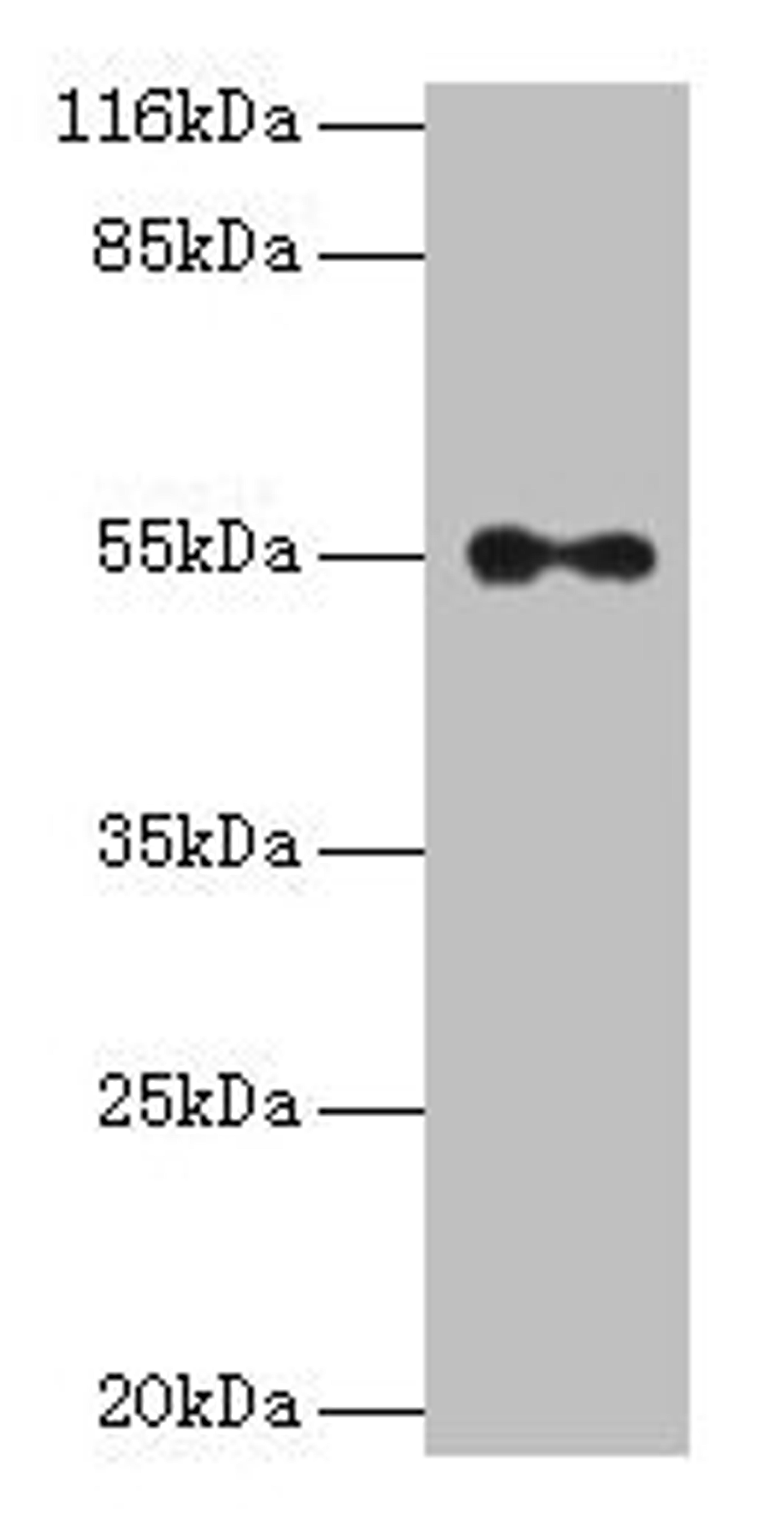 Western blot. All lanes: THRA antibody at 2µg/ml + A431 whole cell lysate. Secondary. Goat polyclonal to rabbit IgG at 1/10000 dilution. Predicted band size: 55, 47, 51 kDa. Observed band size: 55 kDa