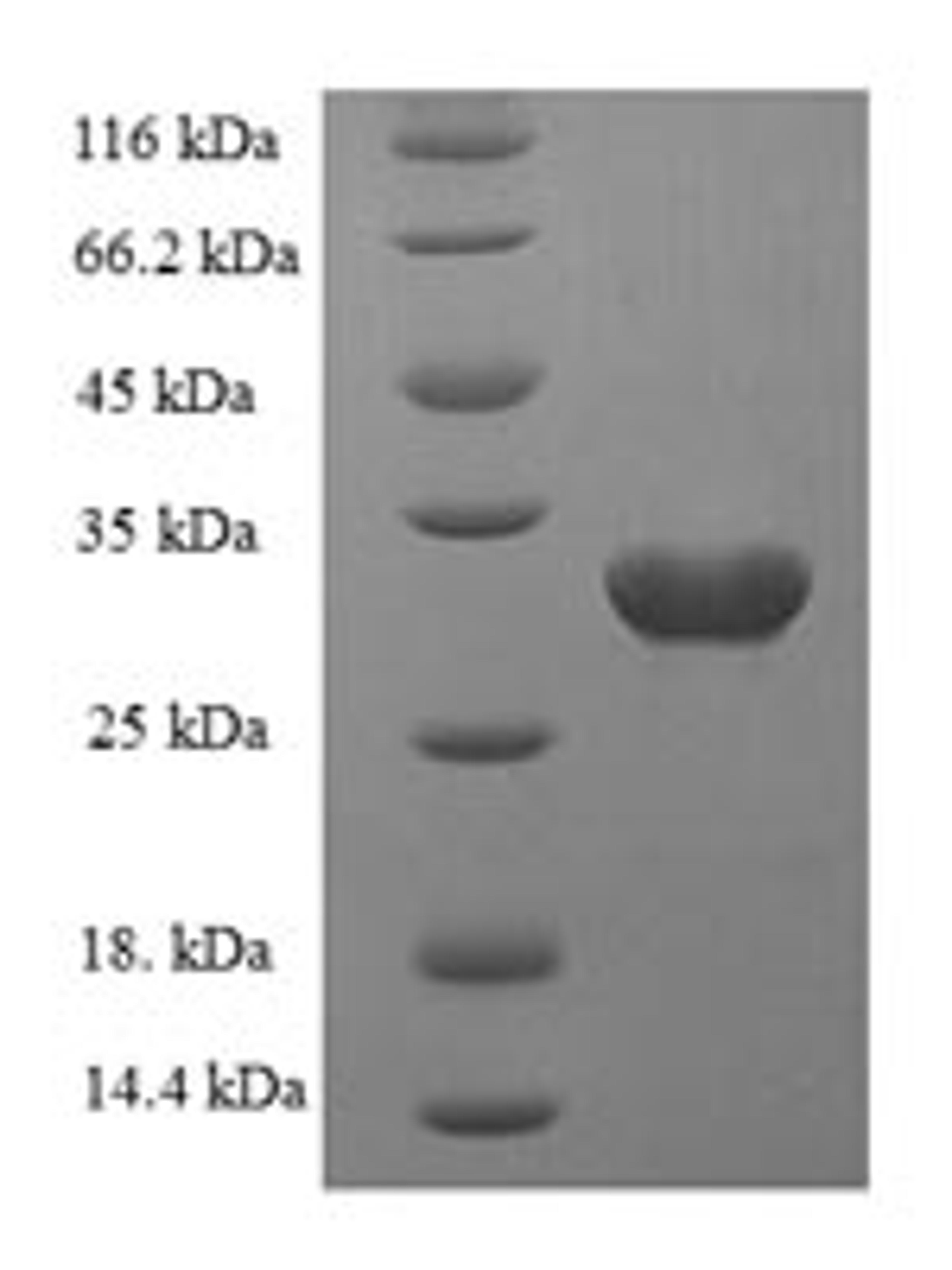 (Tris-Glycine gel) Discontinuous SDS-PAGE (reduced) with 5% enrichment gel and 15% separation gel.
