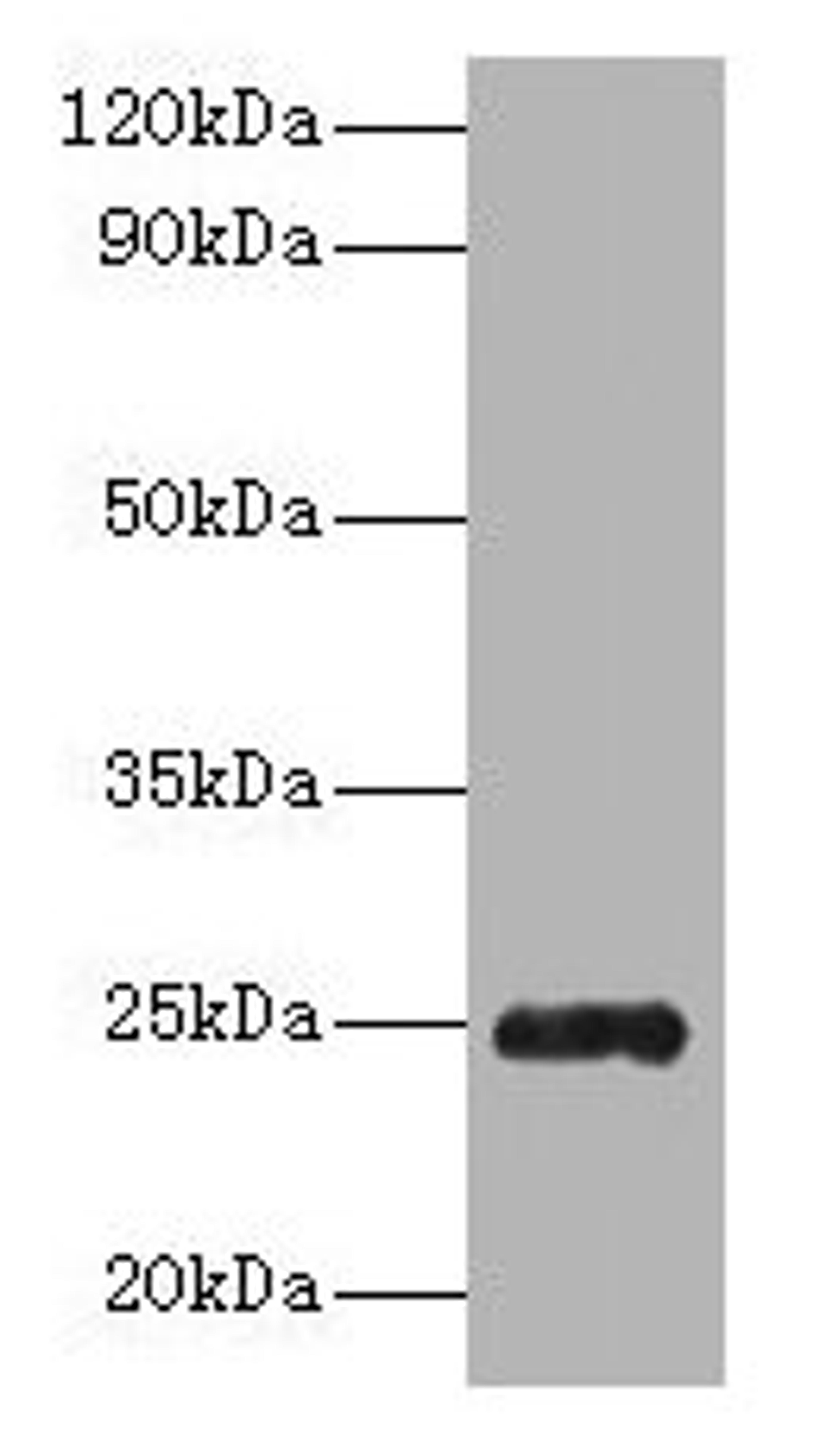 Western blot. All lanes: Trypsin antibody at 2µg/ml + Recombinant Pig Trypsin protein 1µg. Secondary. Goat polyclonal to rabbit IgG at 1/10000 dilution. Predicted band size: 25 kDa. Observed band size: 25 kDa
