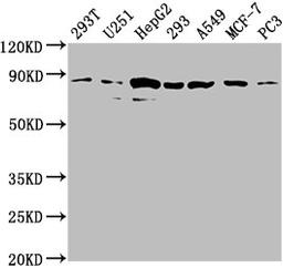 Western Blot. Positive WB detected in: 293T whole cell lysate, U251 whole cell lysate, HepG2 whole cell lysate, 293 whole cell lysate, A549 whole cell lysate, MCF-7 whole cell lysate, PC3 whole cell lysate. All lanes: AMOTL2 antibody at 1:2000. Secondary. Goat polyclonal to rabbit IgG at 1/50000 dilution. Predicted band size: 86, 92 kDa. Observed band size: 86 kDa. 
