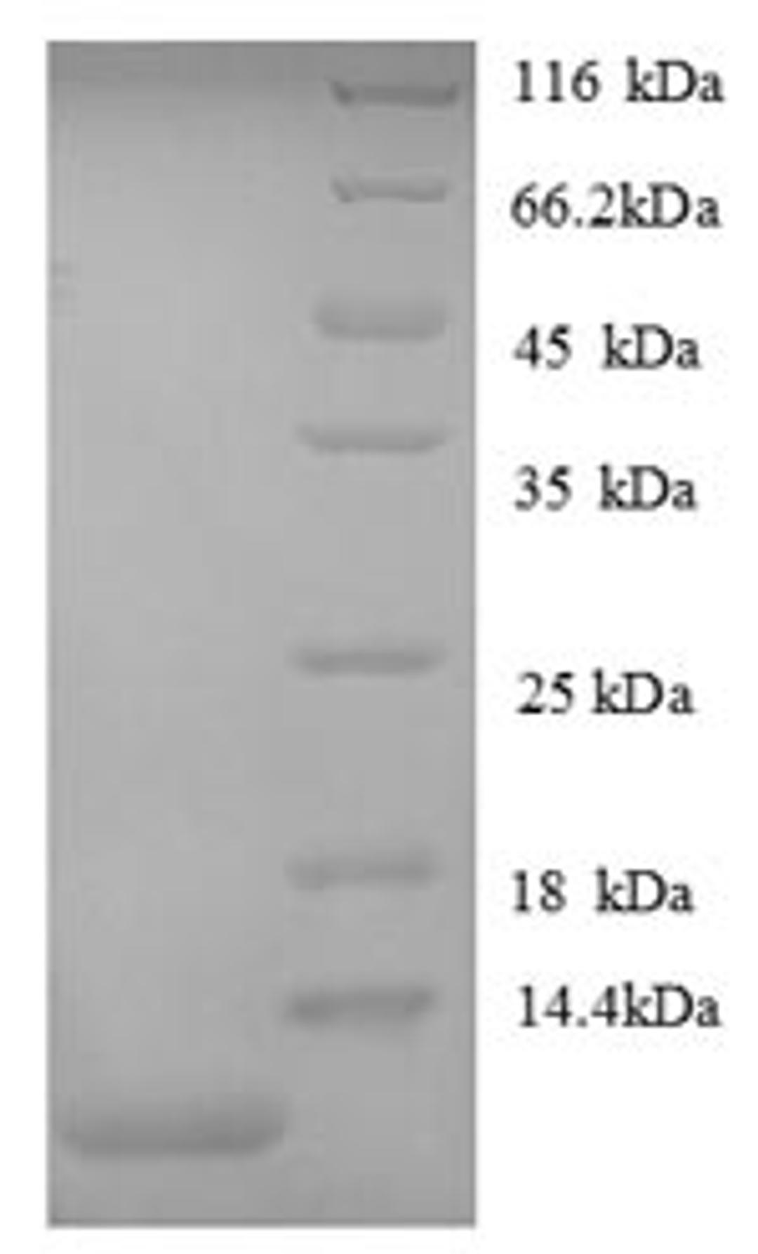 (Tris-Glycine gel) Discontinuous SDS-PAGE (reduced) with 5% enrichment gel and 15% separation gel.