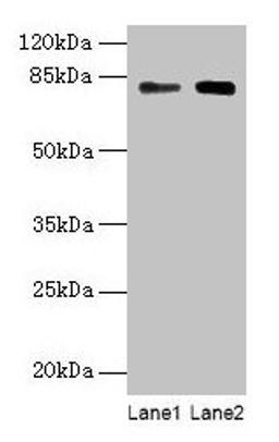 Western blot. All lanes: MASP1 antibody at 6µg/ml. Lane 1: Hela whole cell lysate. Lane 2: U251 whole cell lysate. Secondary. Goat polyclonal to rabbit IgG at 1/10000 dilution. Predicted band size: 80, 82, 44, 69 kDa. Observed band size: 80 kDa