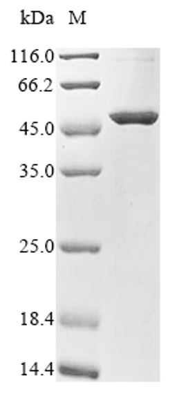 (Tris-Glycine gel) Discontinuous SDS-PAGE (reduced) with 5% enrichment gel and 15% separation gel.
