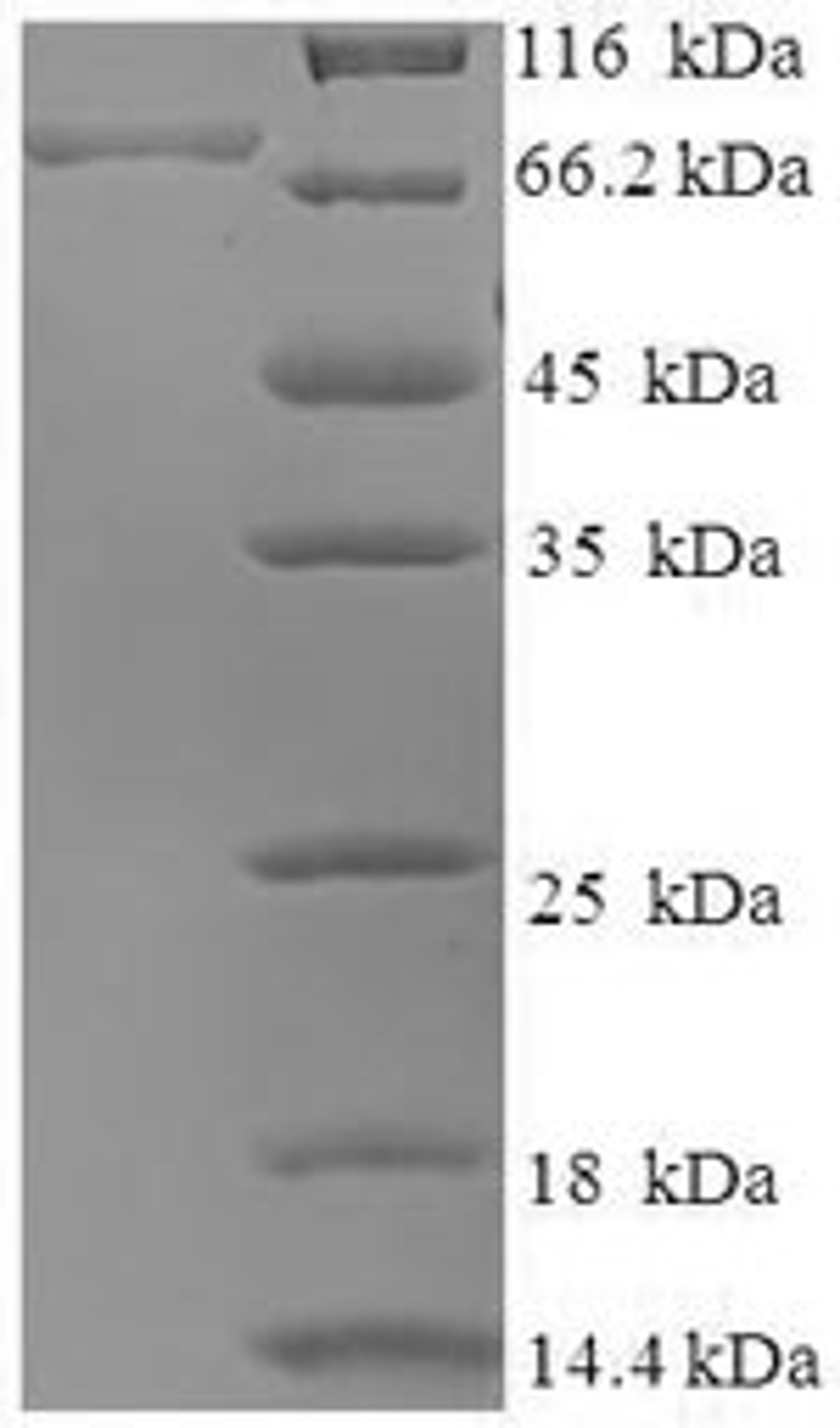 (Tris-Glycine gel) Discontinuous SDS-PAGE (reduced) with 5% enrichment gel and 15% separation gel.