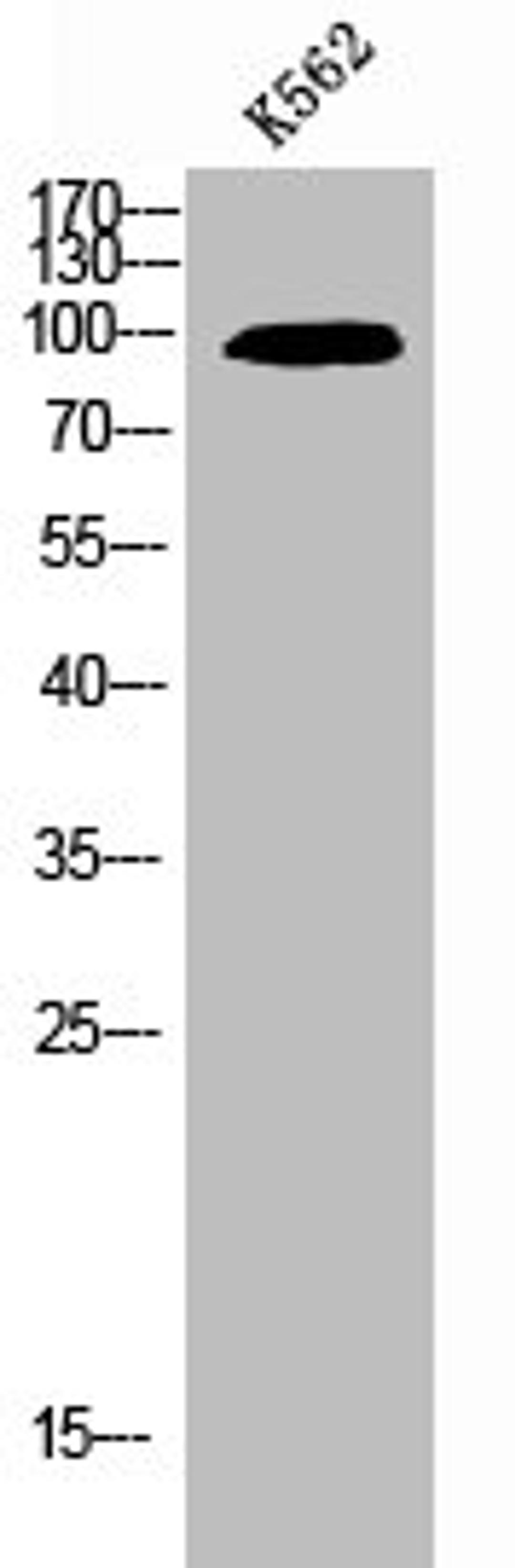 Western Blot analysis of K562 cells using NFκB-p100 Polyclonal Antibody
