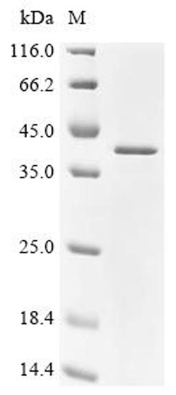 (Tris-Glycine gel) Discontinuous SDS-PAGE (reduced) with 5% enrichment gel and 15% separation gel.