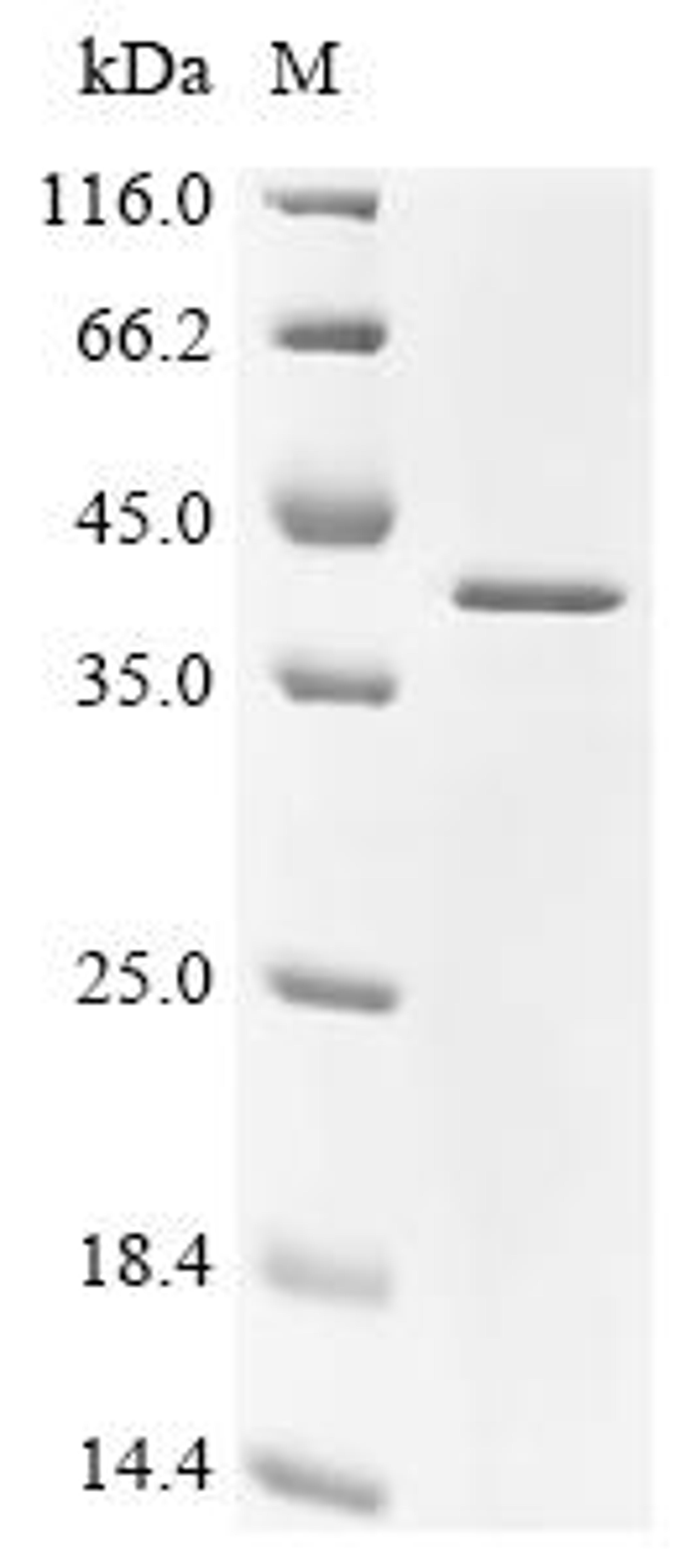 (Tris-Glycine gel) Discontinuous SDS-PAGE (reduced) with 5% enrichment gel and 15% separation gel.