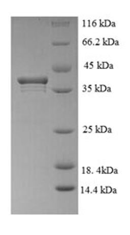 (Tris-Glycine gel) Discontinuous SDS-PAGE (reduced) with 5% enrichment gel and 15% separation gel.