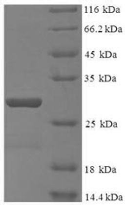 (Tris-Glycine gel) Discontinuous SDS-PAGE (reduced) with 5% enrichment gel and 15% separation gel.