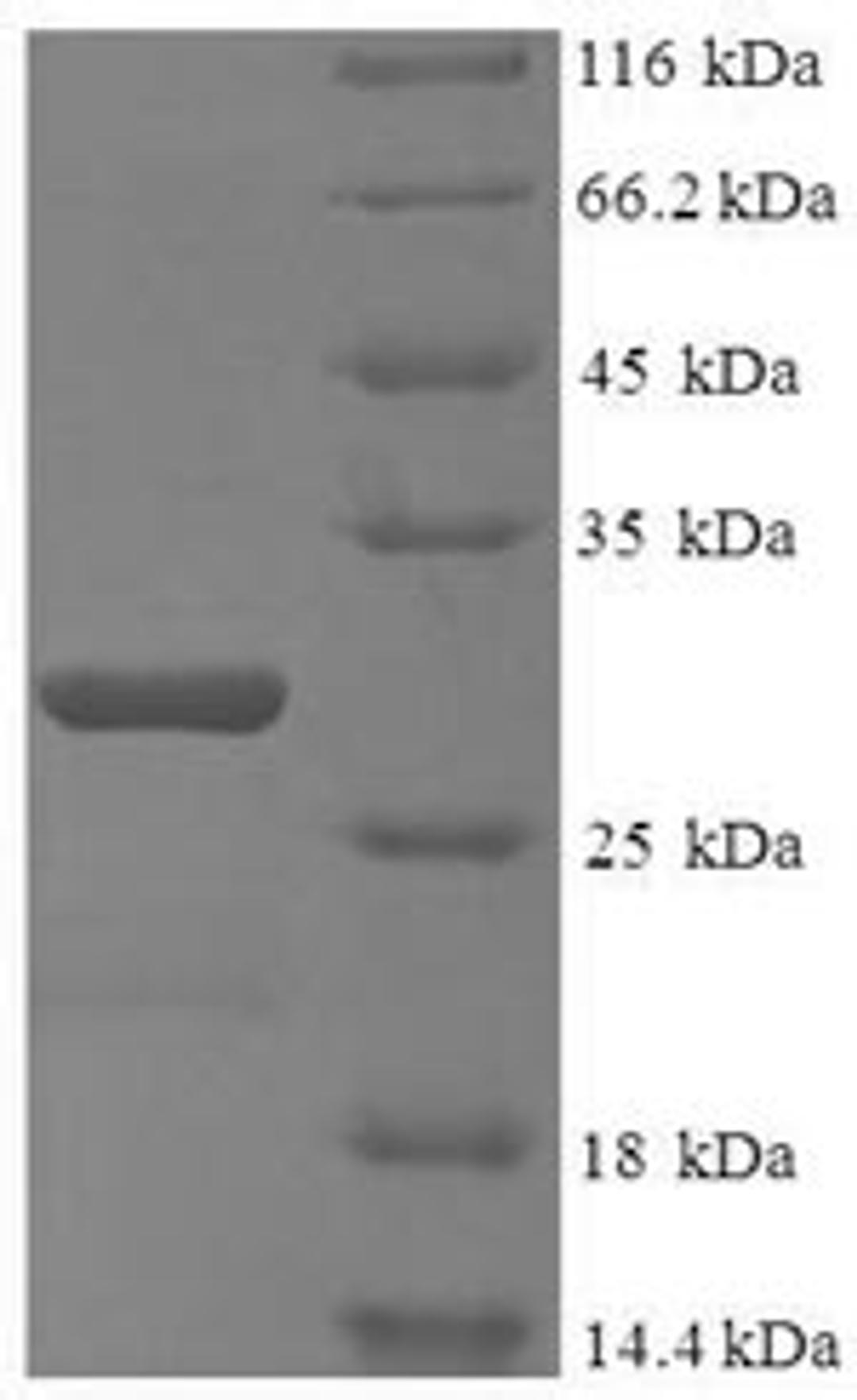 (Tris-Glycine gel) Discontinuous SDS-PAGE (reduced) with 5% enrichment gel and 15% separation gel.