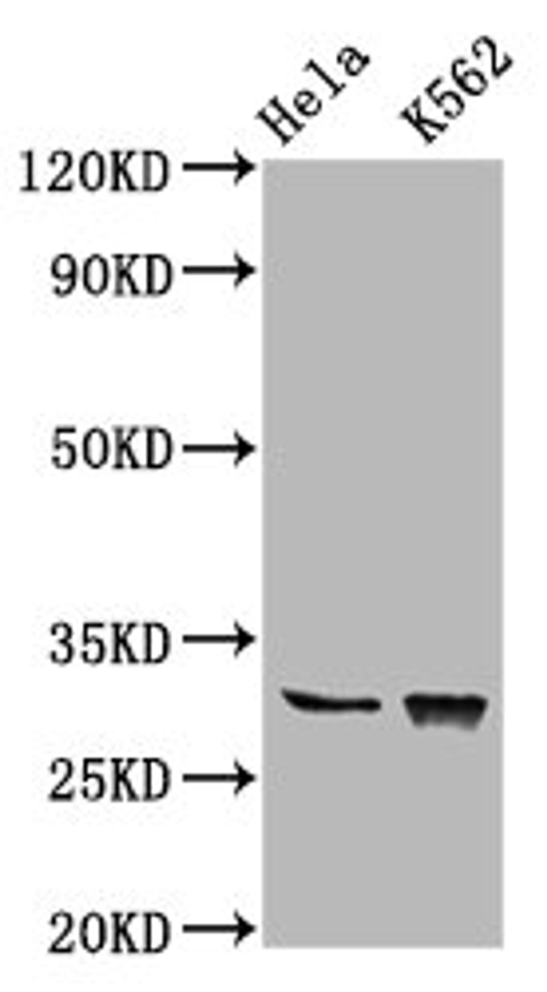 Western Blot. Positive WB detected in: Hela whole cell lysate, K562 whole cell lysate. All lanes: CHODL antibody at 6.2µg/ml. Secondary. Goat polyclonal to rabbit IgG at 1/50000 dilution. Predicted band size: 31, 26, 28, 29 kDa. Observed band size: 31 kDa
