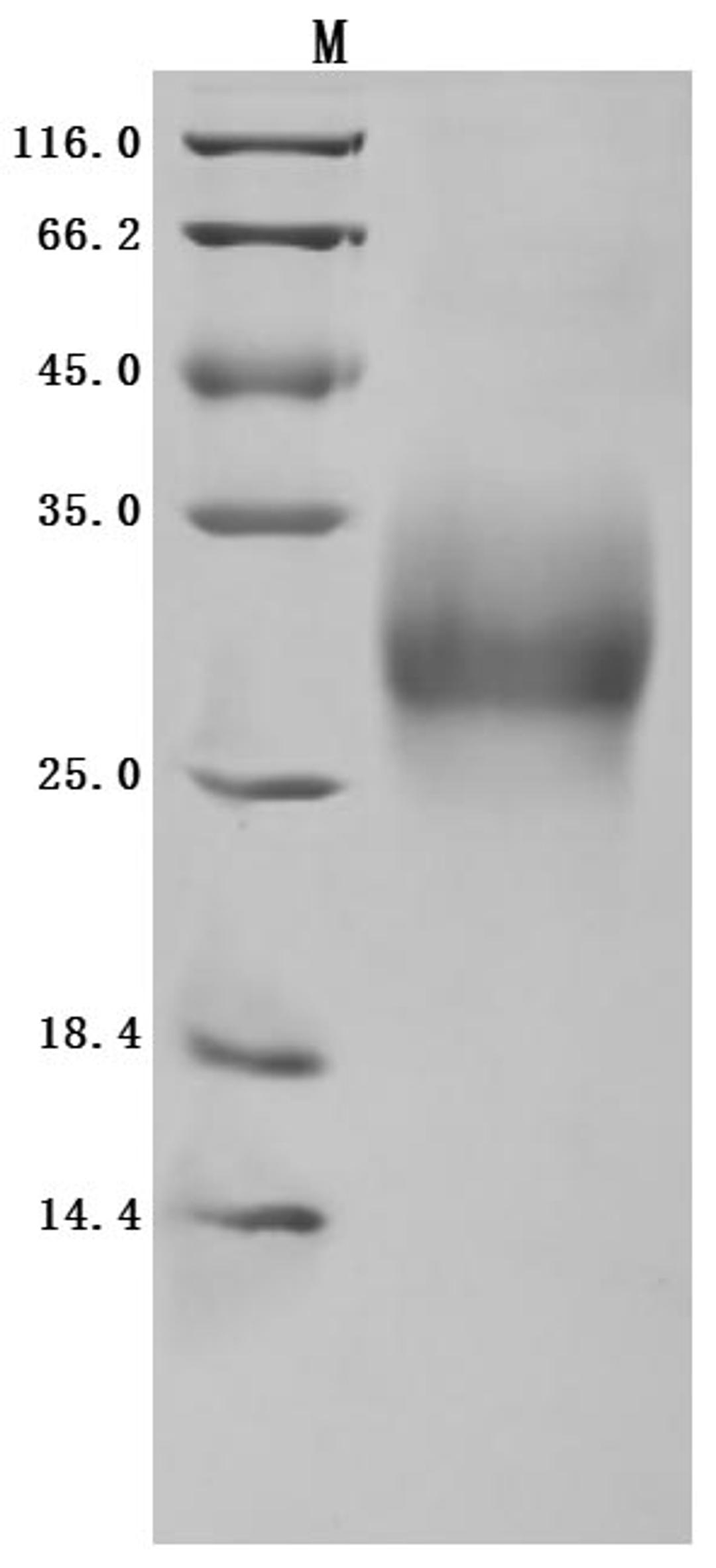 (Tris-Glycine gel) Discontinuous SDS-PAGE (reduced) with 5% enrichment gel and 15% separation gel.