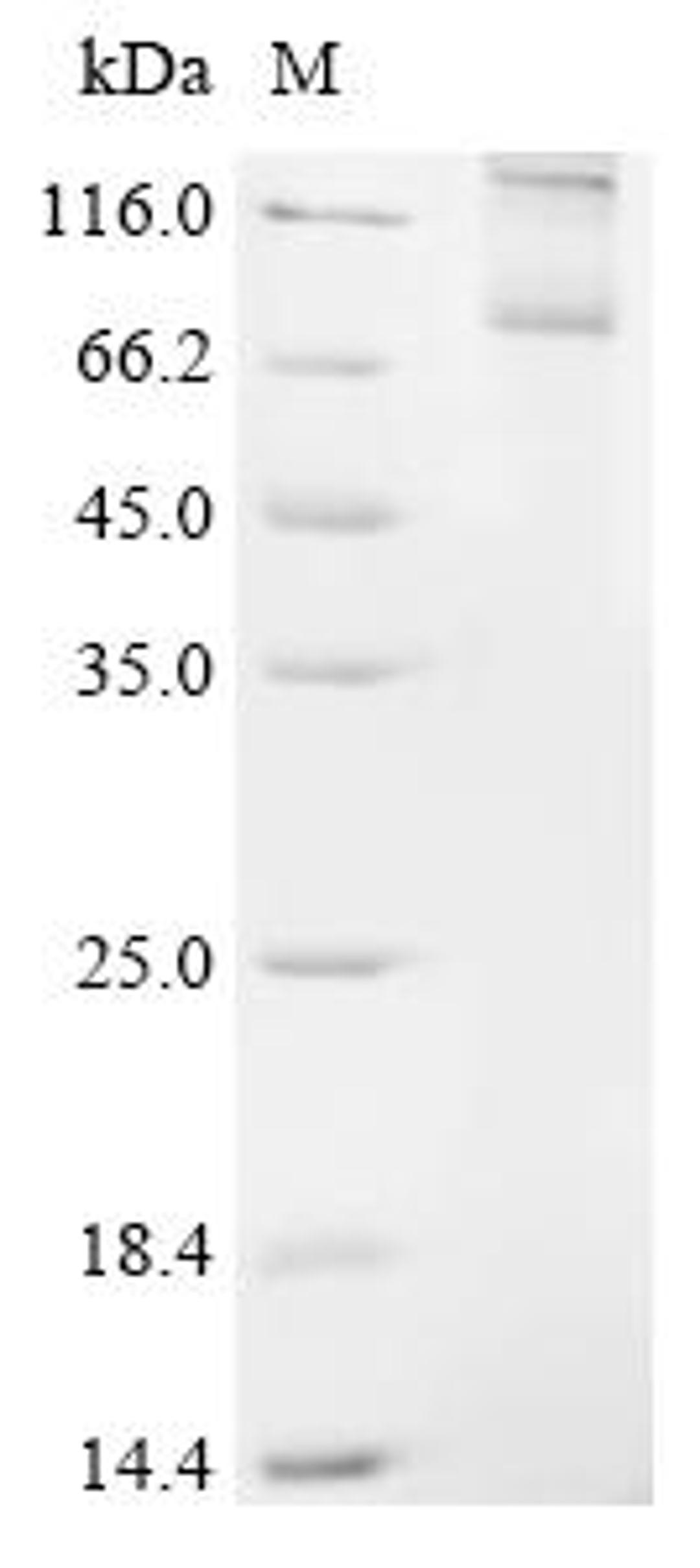 (Tris-Glycine gel) Discontinuous SDS-PAGE (reduced) with 5% enrichment gel and 15% separation gel.