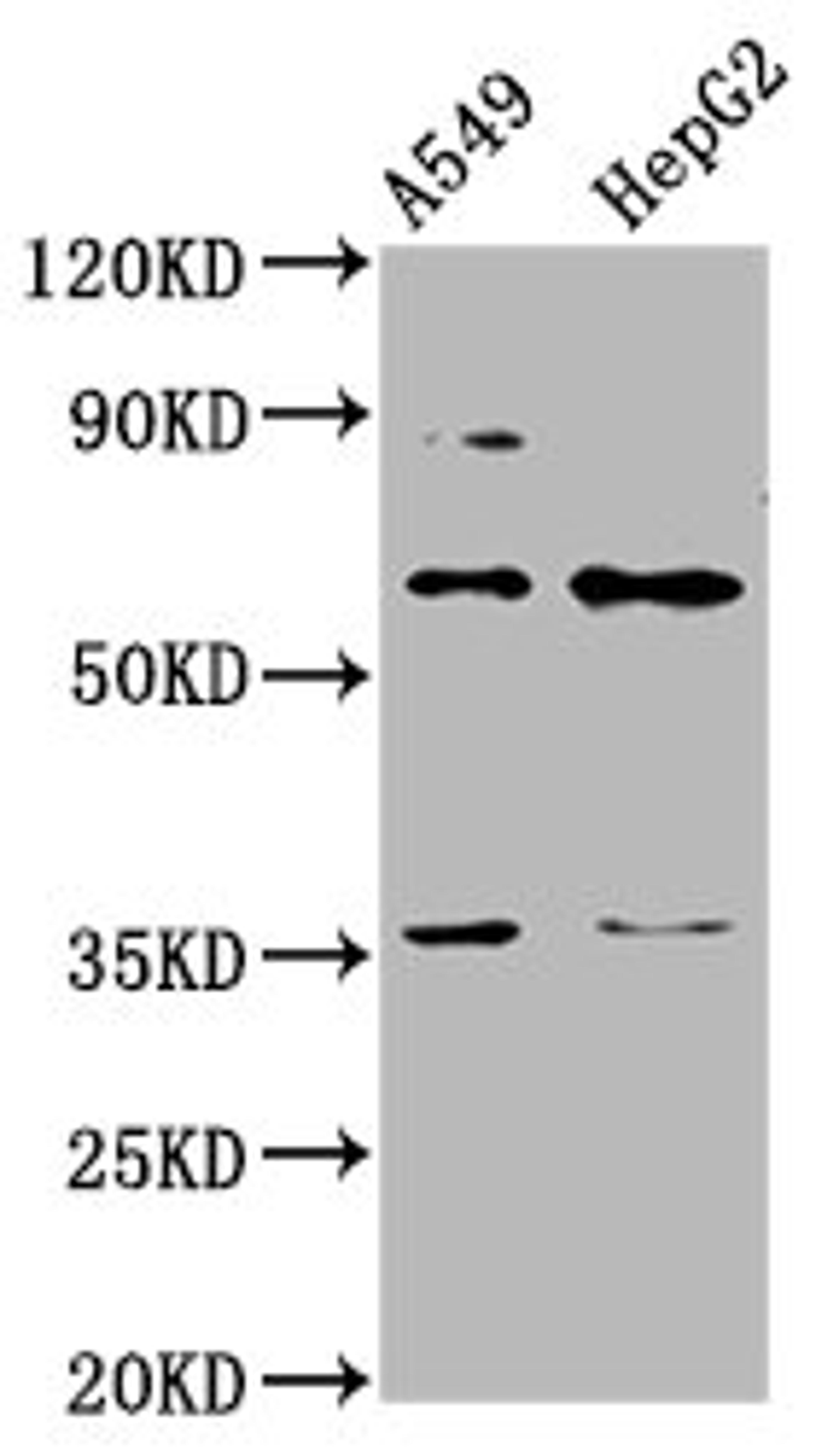 Western Blot. Positive WB detected in: A549 whole cell lysate, HepG2 whole cell lysate. All lanes: TBX4 antibody at 4.3µg/ml. Secondary. Goat polyclonal to rabbit IgG at 1/50000 dilution. Predicted band size: 61 kDa. Observed band size: 61 kDa