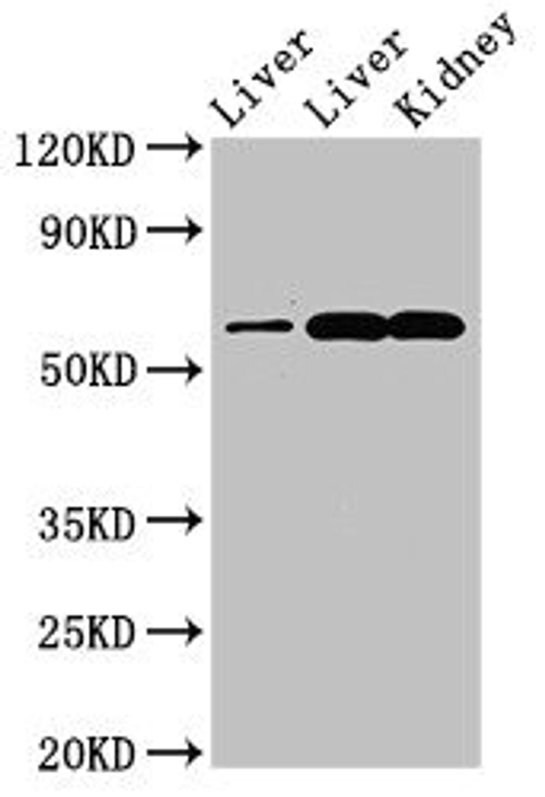 Western Blot. Positive WB detected in: Rat liver tissue, Mouse liver tissue, Mouse kidney tissue. All lanes: ZNF695 antibody at 3.4ug/ml. Secondary. Goat polyclonal to rabbit IgG at 1/50000 dilution. Predicted band size: 61, 21, 16, 11 kDa. Observed band size: 61 kDa.