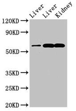 Western Blot. Positive WB detected in: Rat liver tissue, Mouse liver tissue, Mouse kidney tissue. All lanes: ZNF695 antibody at 3.4ug/ml. Secondary. Goat polyclonal to rabbit IgG at 1/50000 dilution. Predicted band size: 61, 21, 16, 11 kDa. Observed band size: 61 kDa.