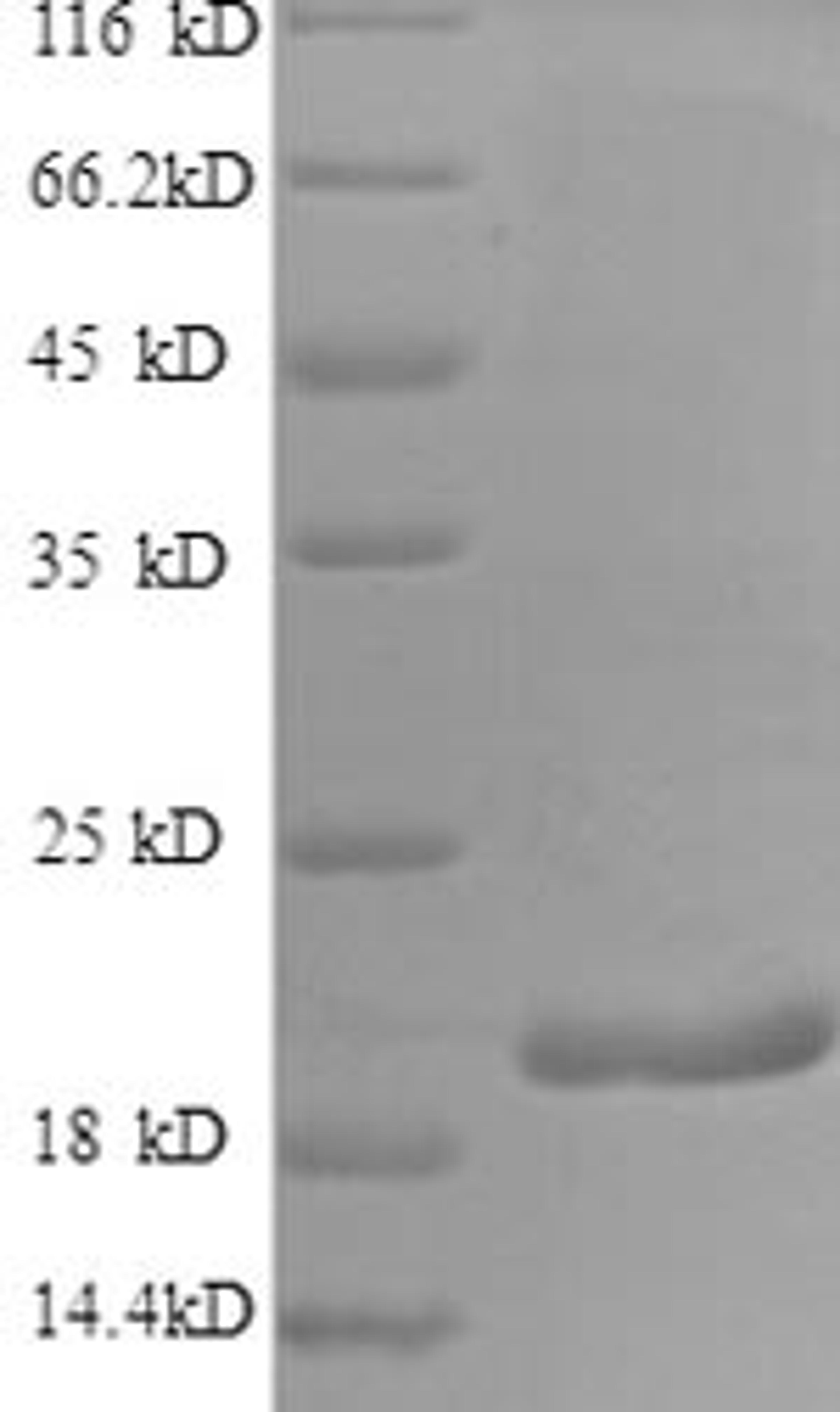 (Tris-Glycine gel) Discontinuous SDS-PAGE (reduced) with 5% enrichment gel and 15% separation gel.