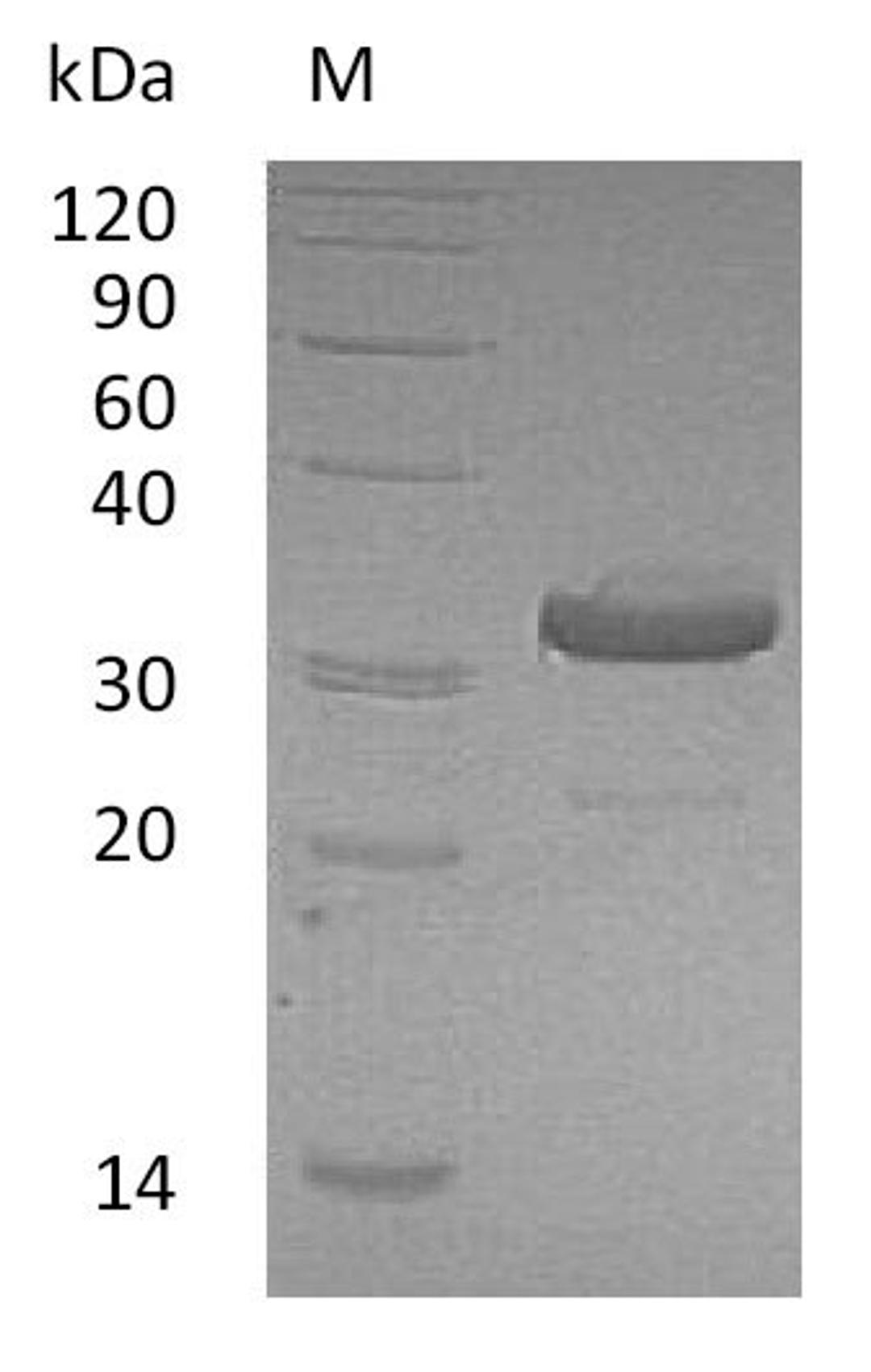 (Tris-Glycine gel) Discontinuous SDS-PAGE (reduced) with 5% enrichment gel and 15% separation gel.
