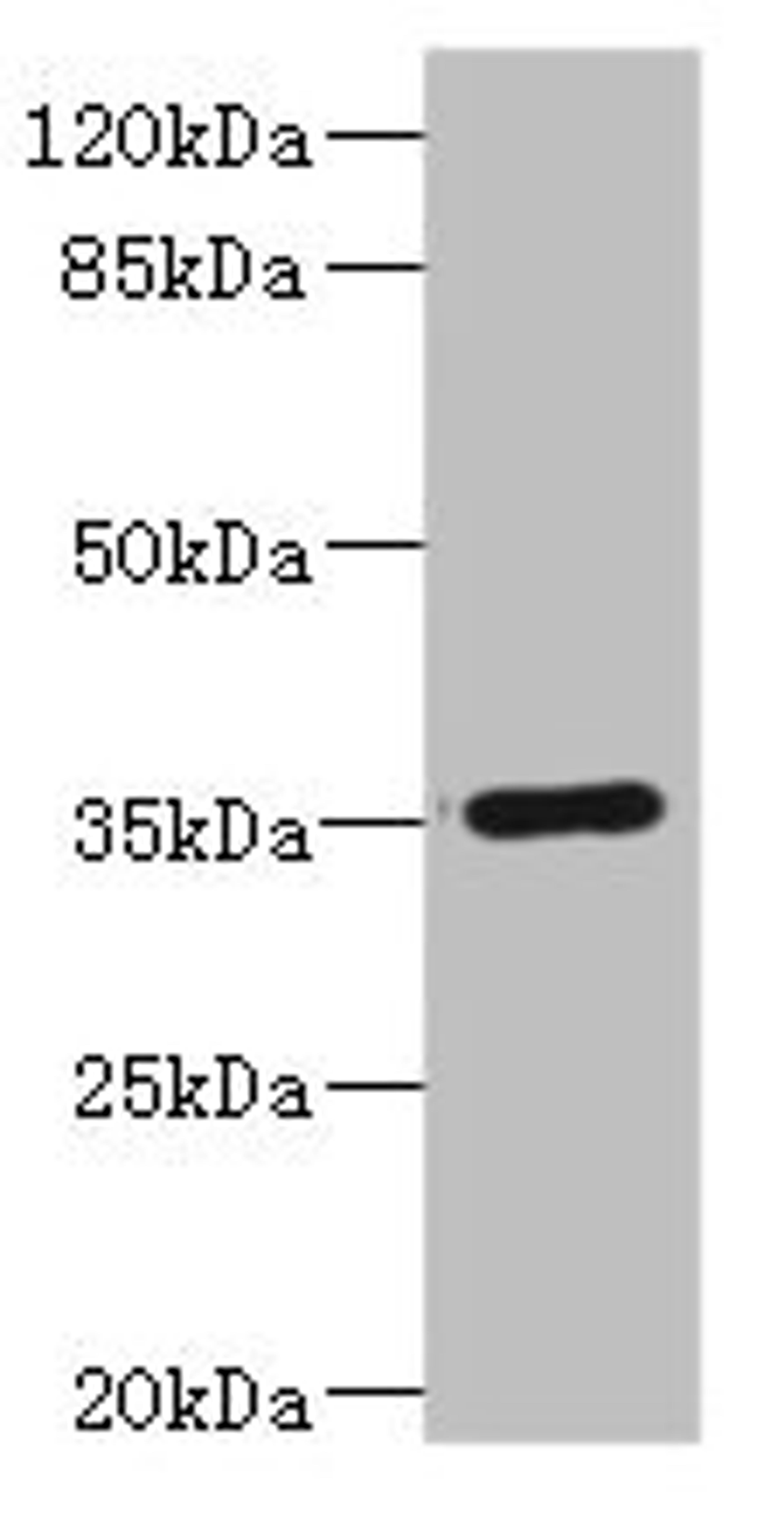 Western blot. All lanes: FCGR2C antibody IgG at 1.67ug/ml + Human Burkitt lymphoma cells. Secondary. Goat polyclonal to rabbit IgG at 1/10000 dilution. Predicted band size: 36, 31, 30, 26 kDa. Observed band size: 36 kDa.